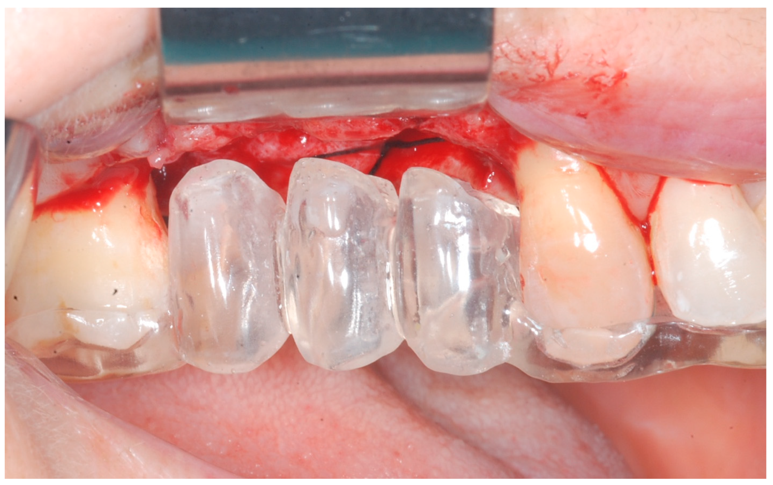 Medicina 61 01814 g003 Medicina 61 01814 g003