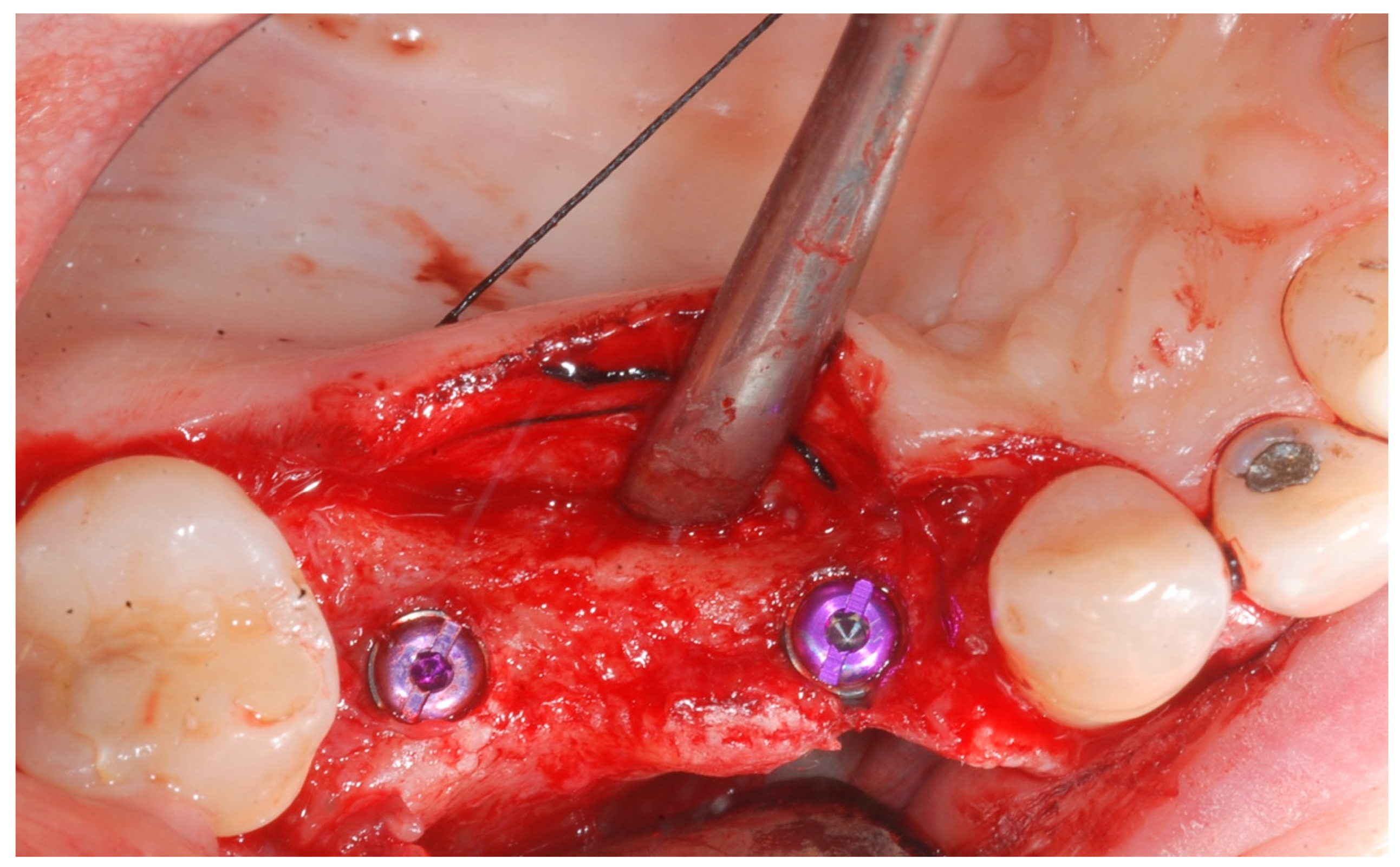 Medicina 61 01814 g004 Medicina 61 01814 g004