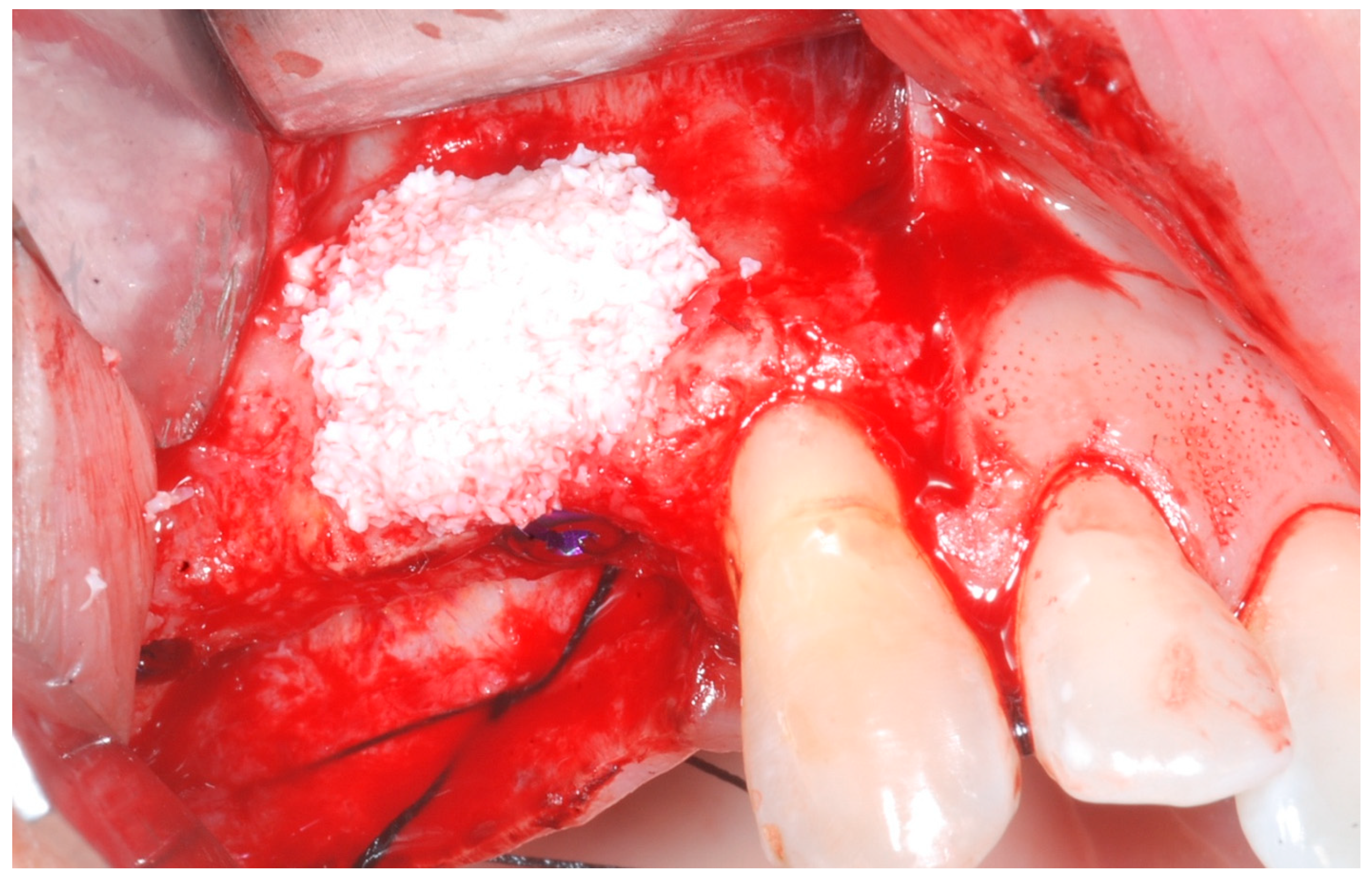 Medicina 61 01814 g005 Medicina 61 01814 g005