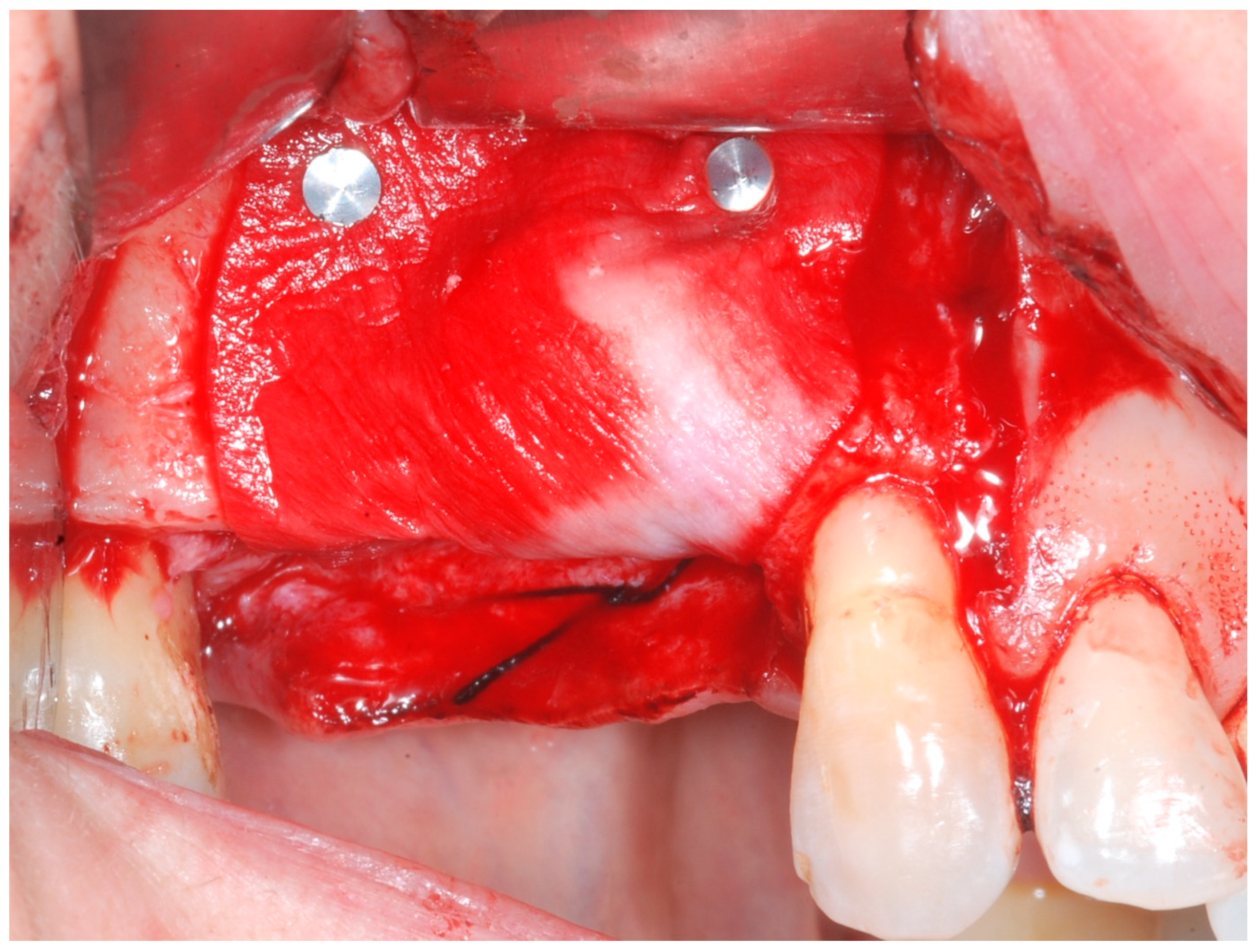 Medicina 61 01814 g006 Medicina 61 01814 g006