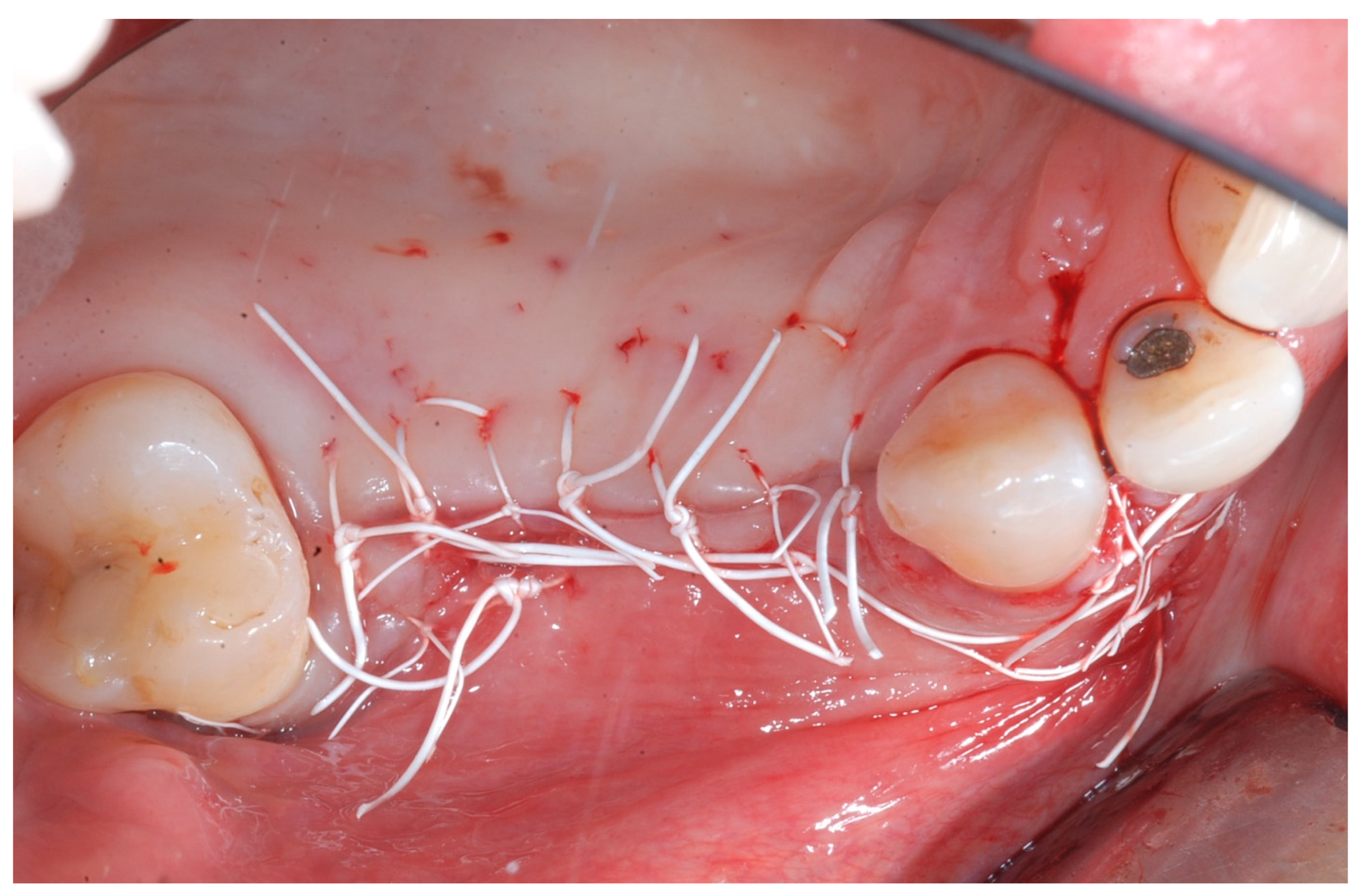 Medicina 61 01814 g007 Medicina 61 01814 g007
