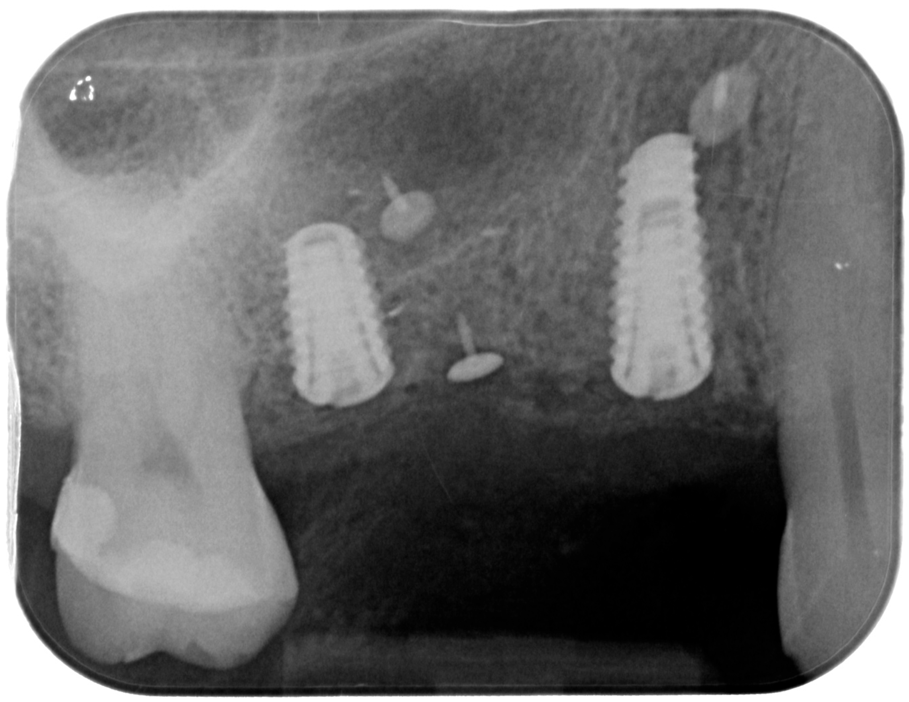 Medicina 61 01814 g008 Medicina 61 01814 g008