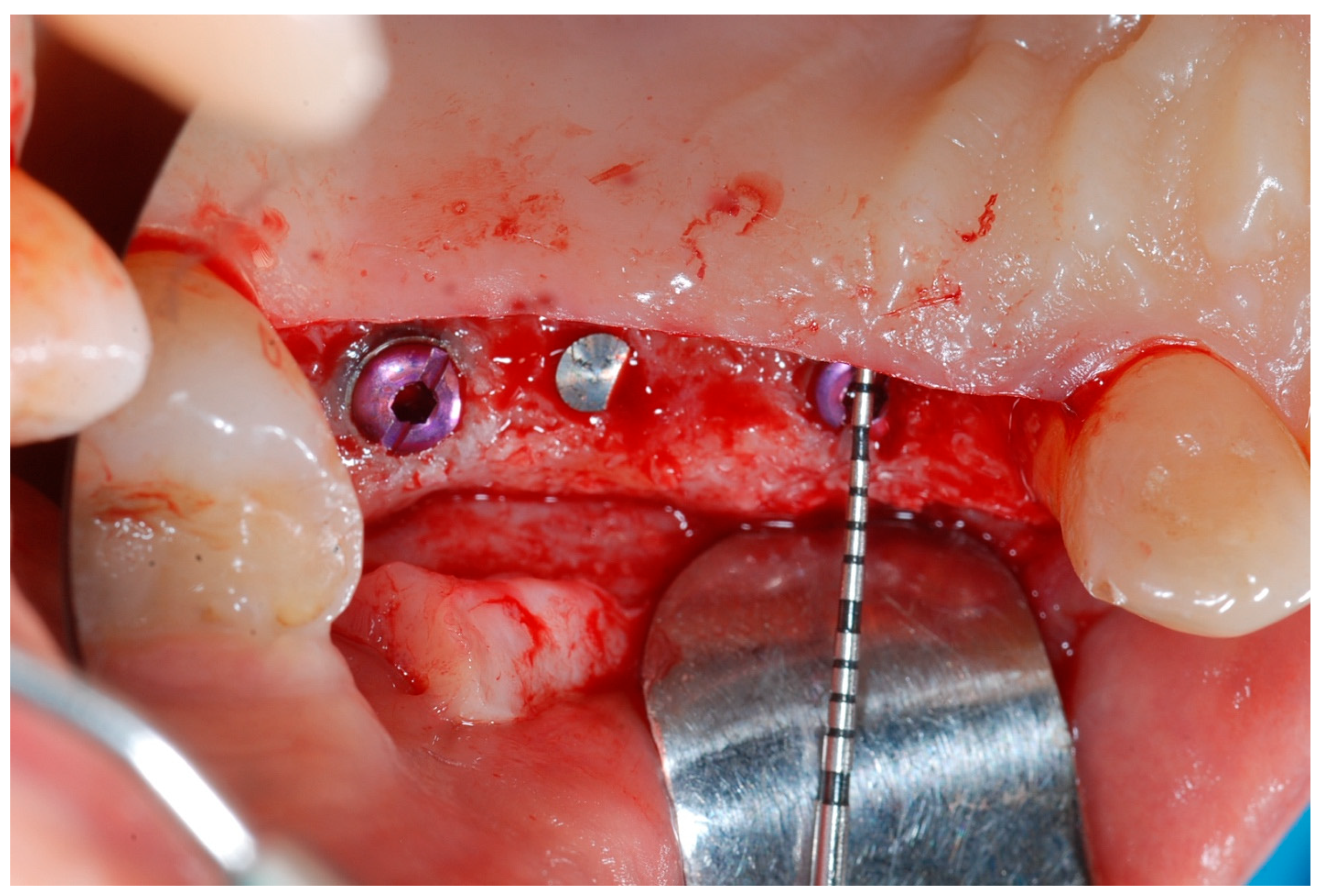 Medicina 61 01814 g009 Medicina 61 01814 g009