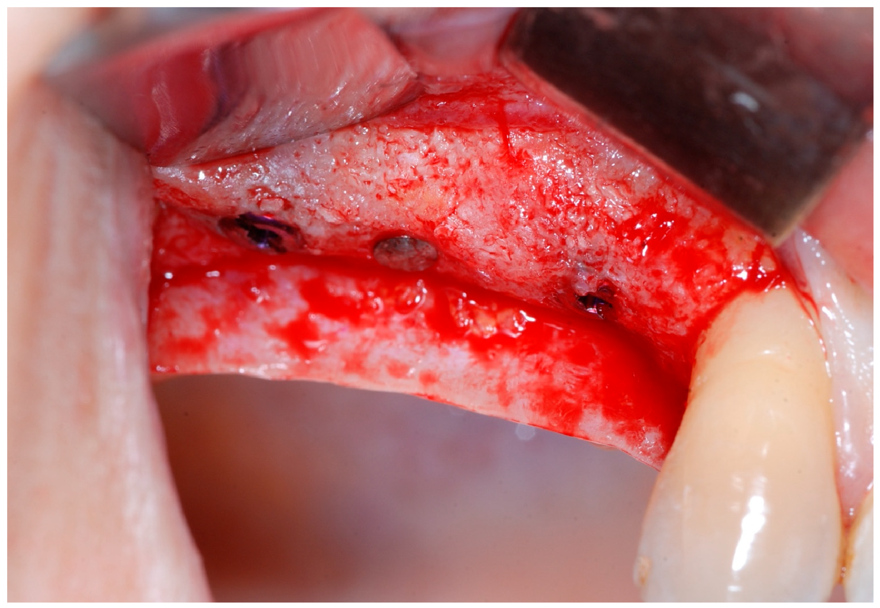 Medicina 61 01814 g010 Medicina 61 01814 g010