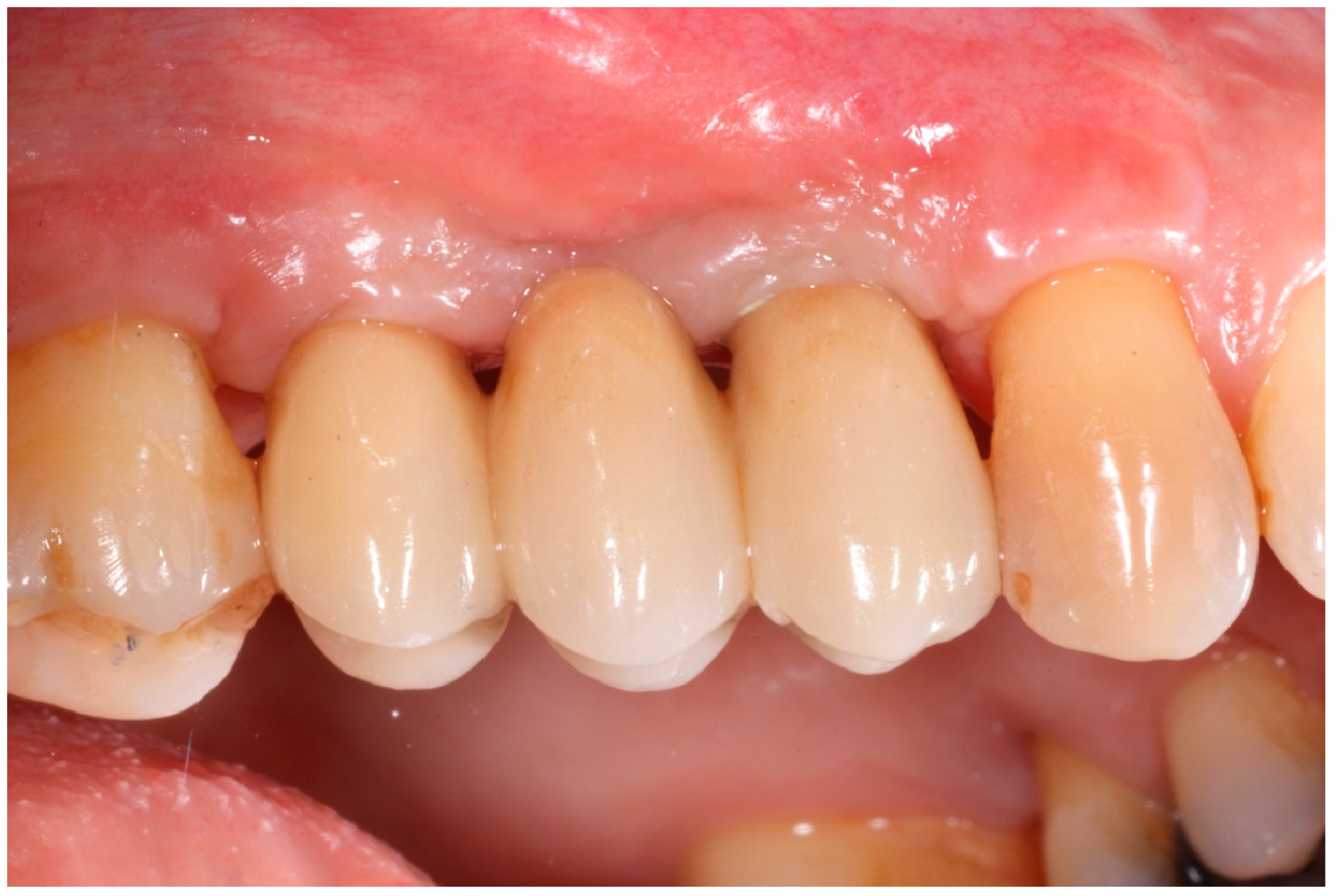 Medicina 61 01814 g011 Medicina 61 01814 g011