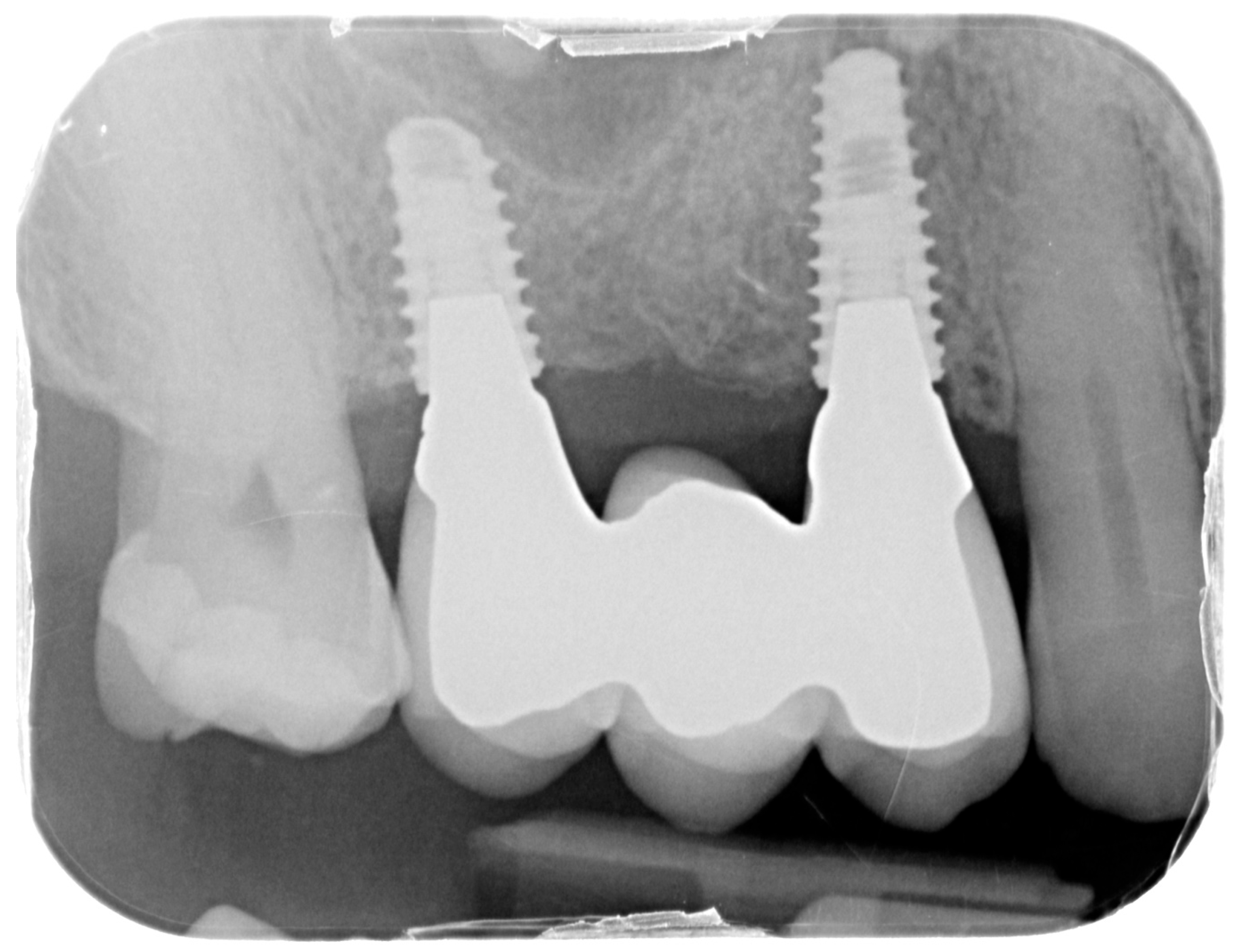 Medicina 61 01814 g013 Medicina 61 01814 g013
