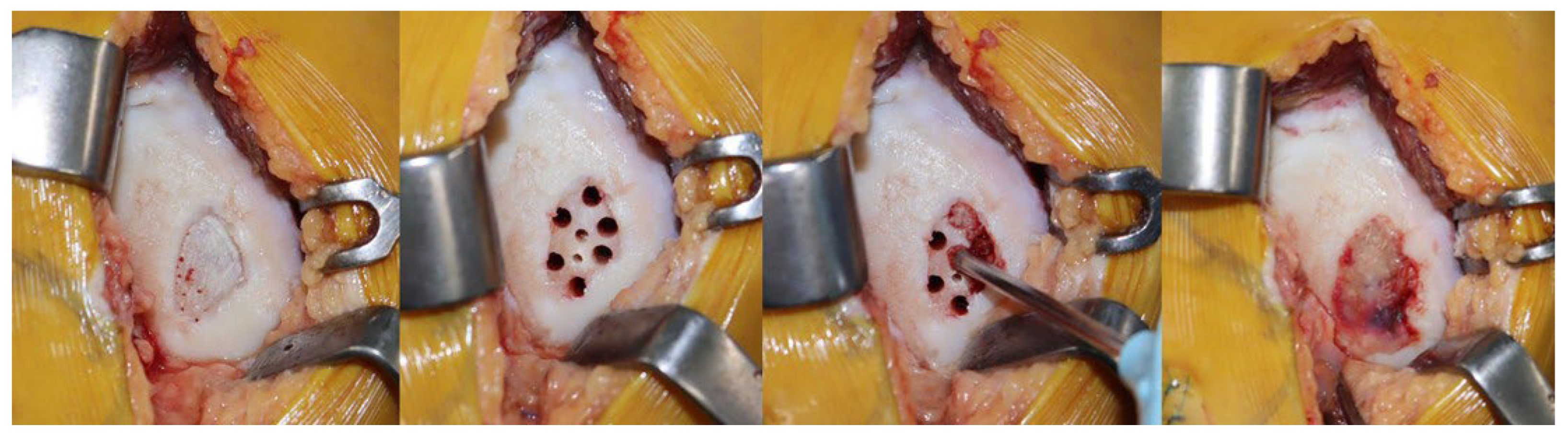 Medicina 62 00289 g001 Medicina 62 00289 g001