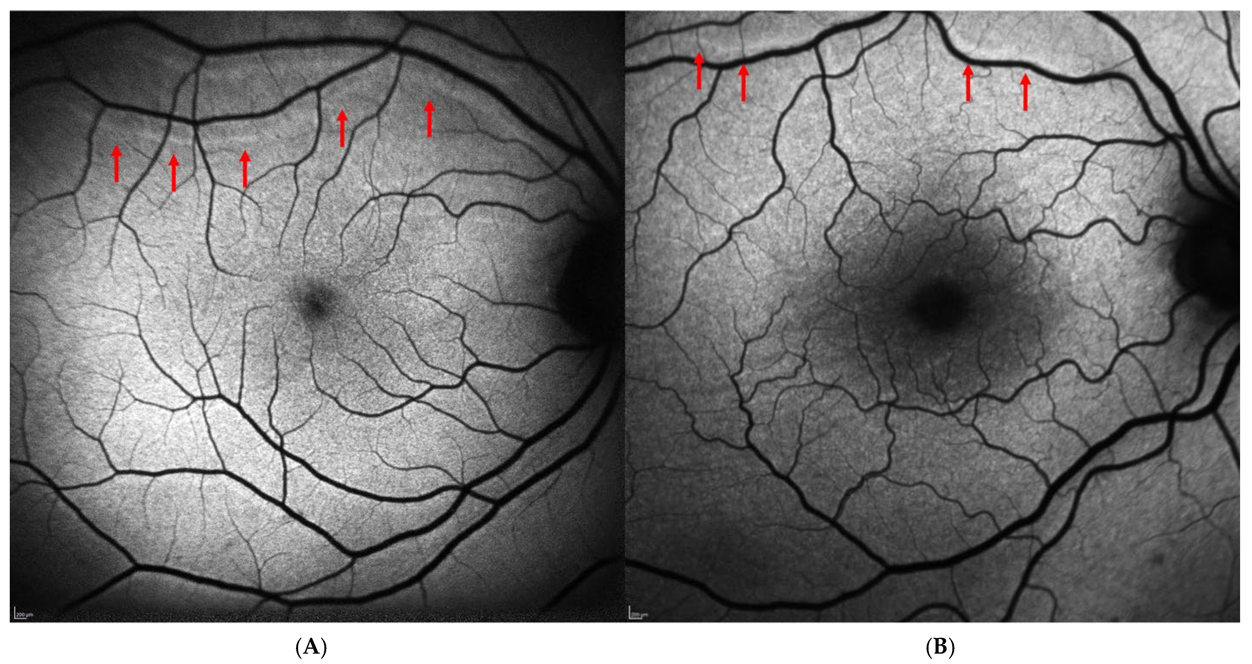 Medicina 62 00308 g001