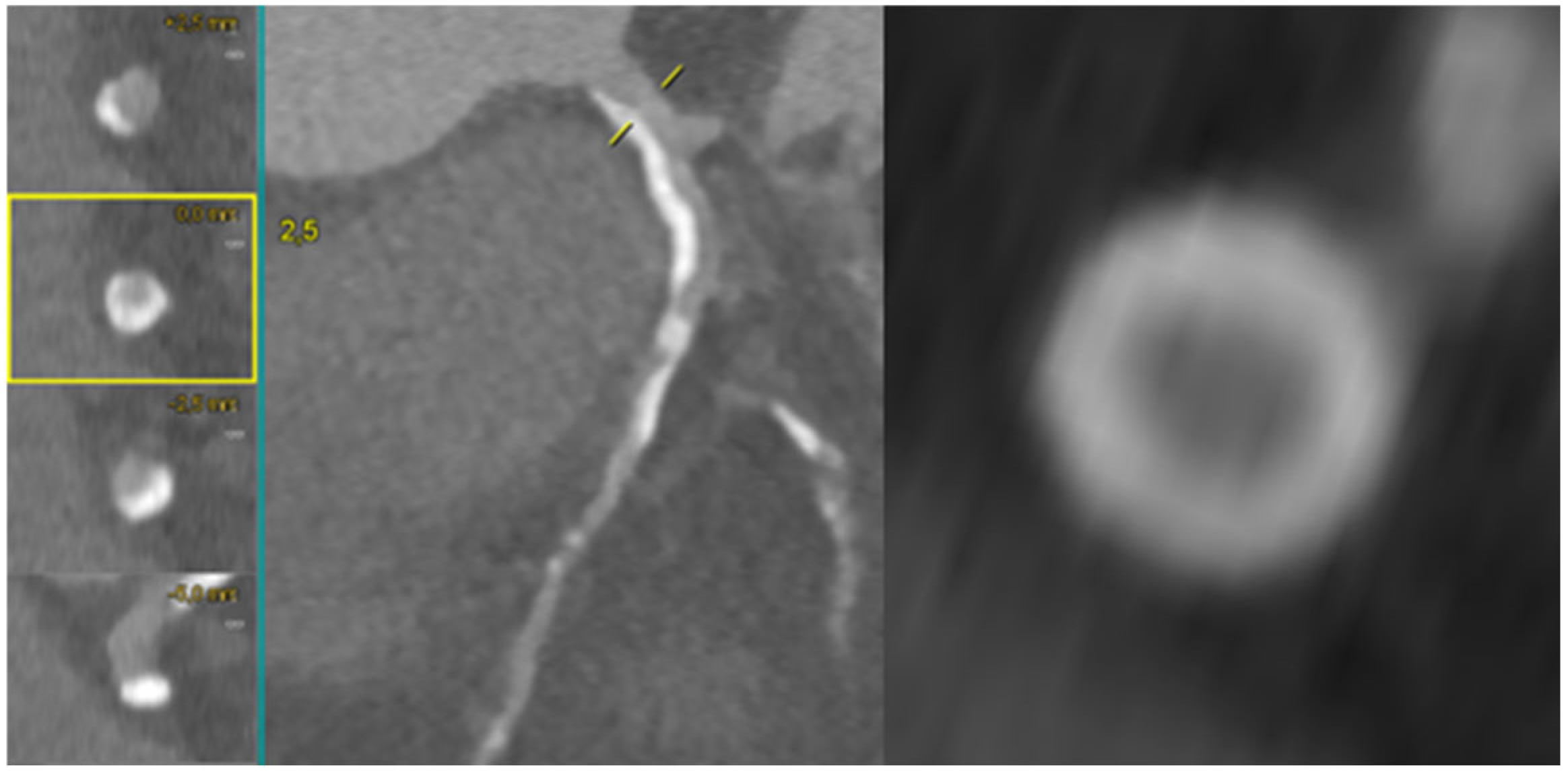 Medicina 62 00313 g001