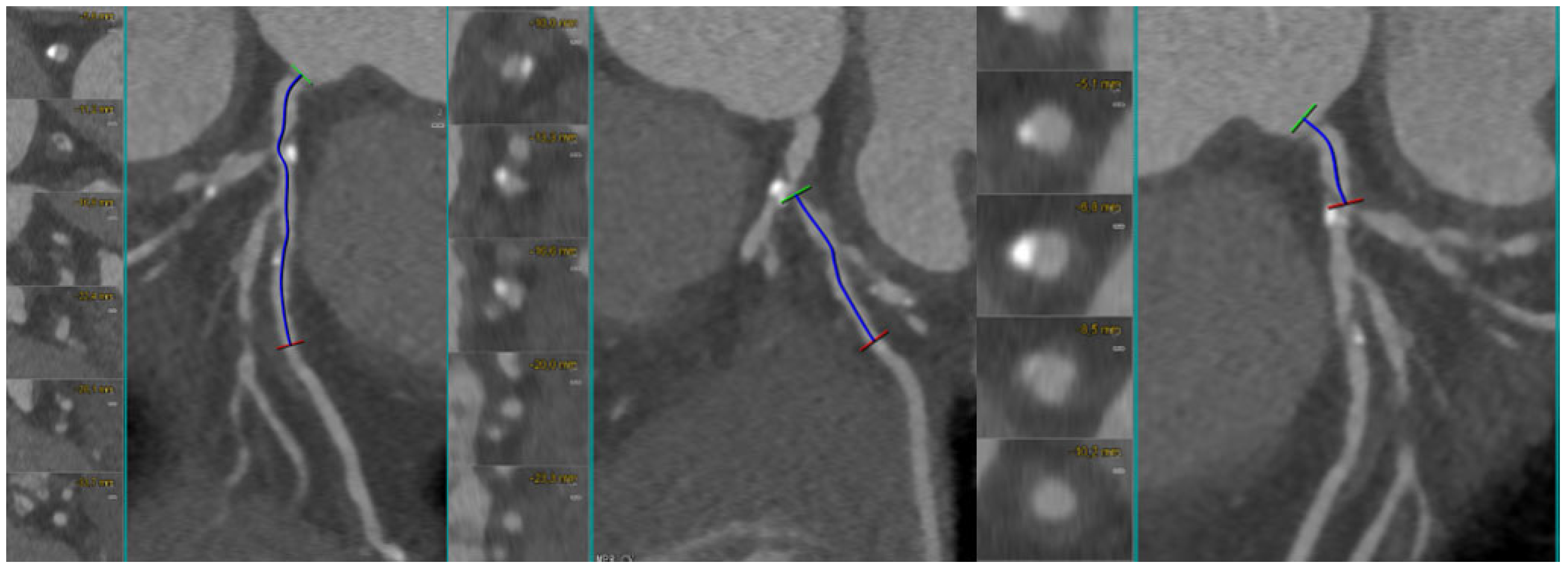 Medicina 62 00313 g004
