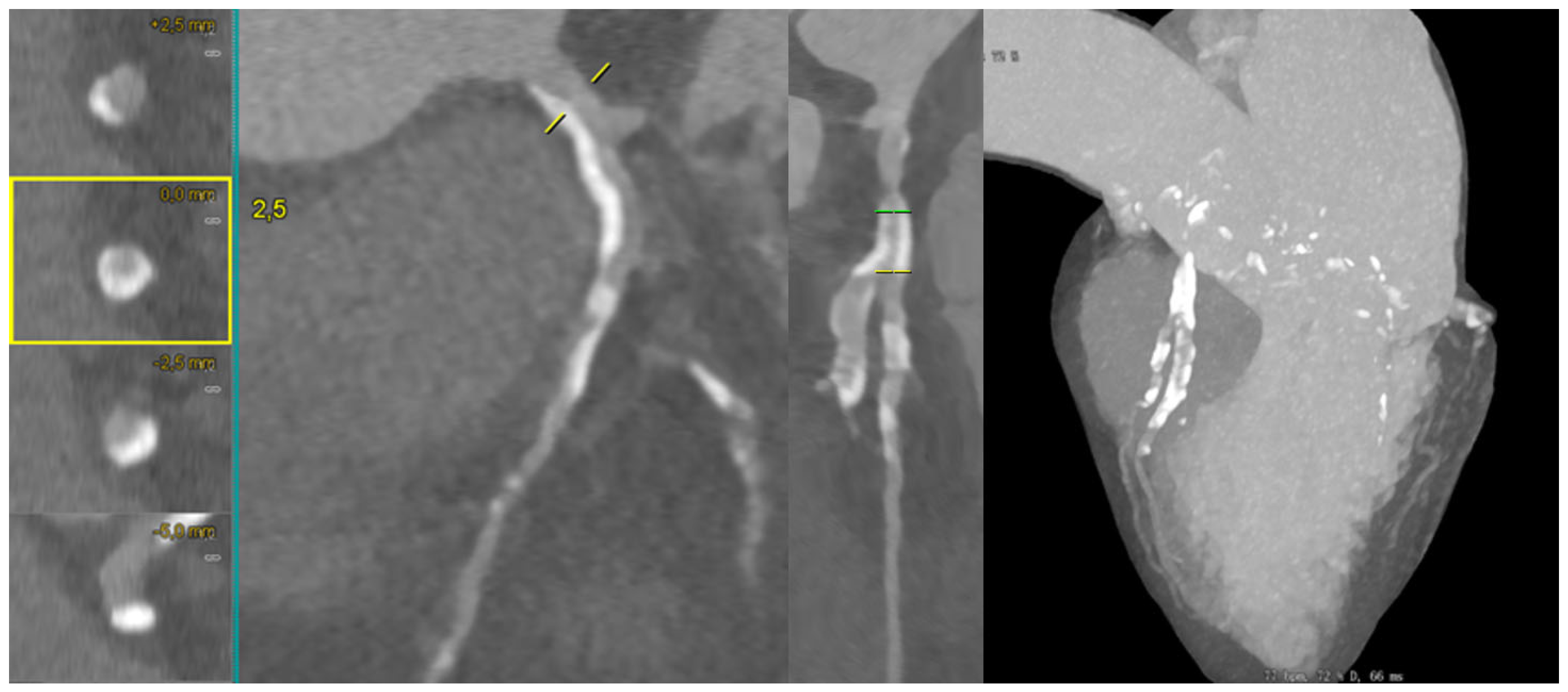 Medicina 62 00313 g006