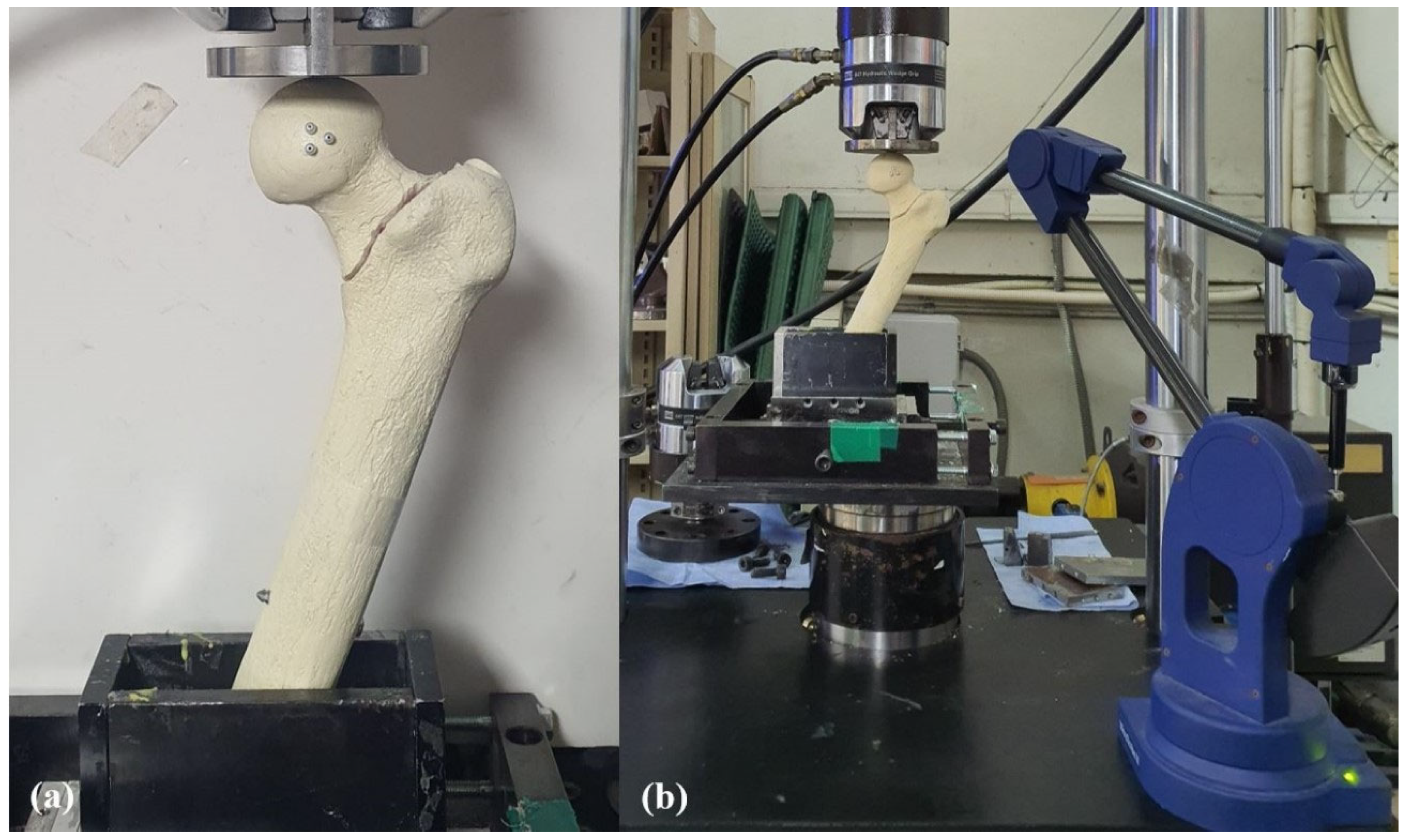 Medicina 62 00322 g003 Medicina 62 00322 g003