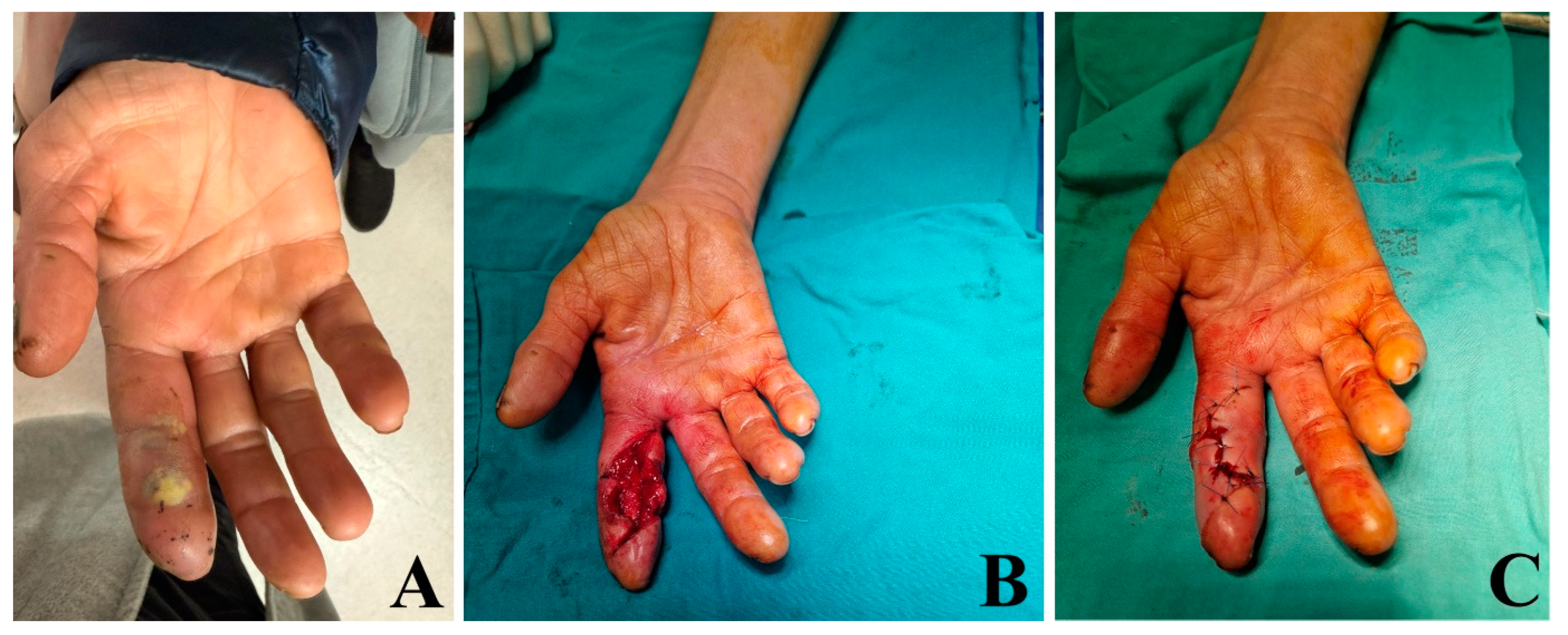 Medicina 62 00534 g001