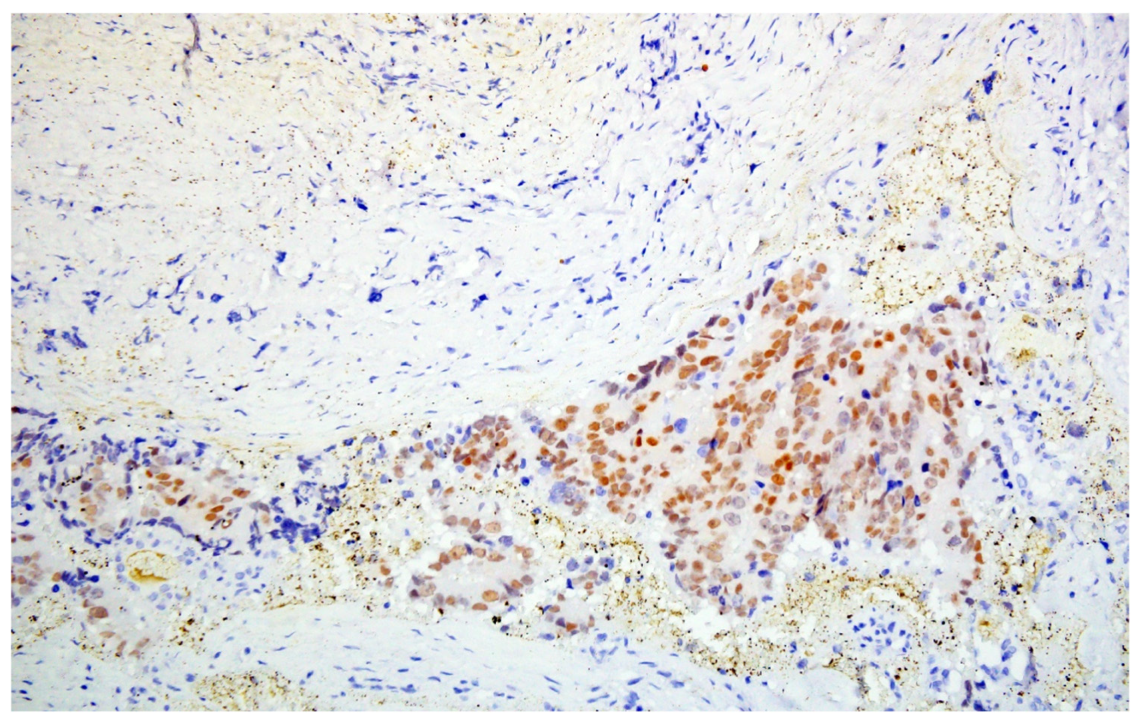 Medicina 62 01465 g005