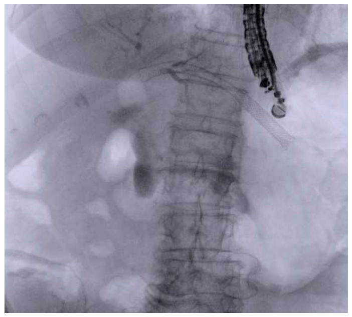 Medicina 62 01678 g002