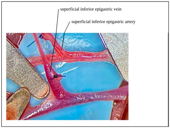 A Stepwise Preclinical Microvascular Training Model Based on the ...