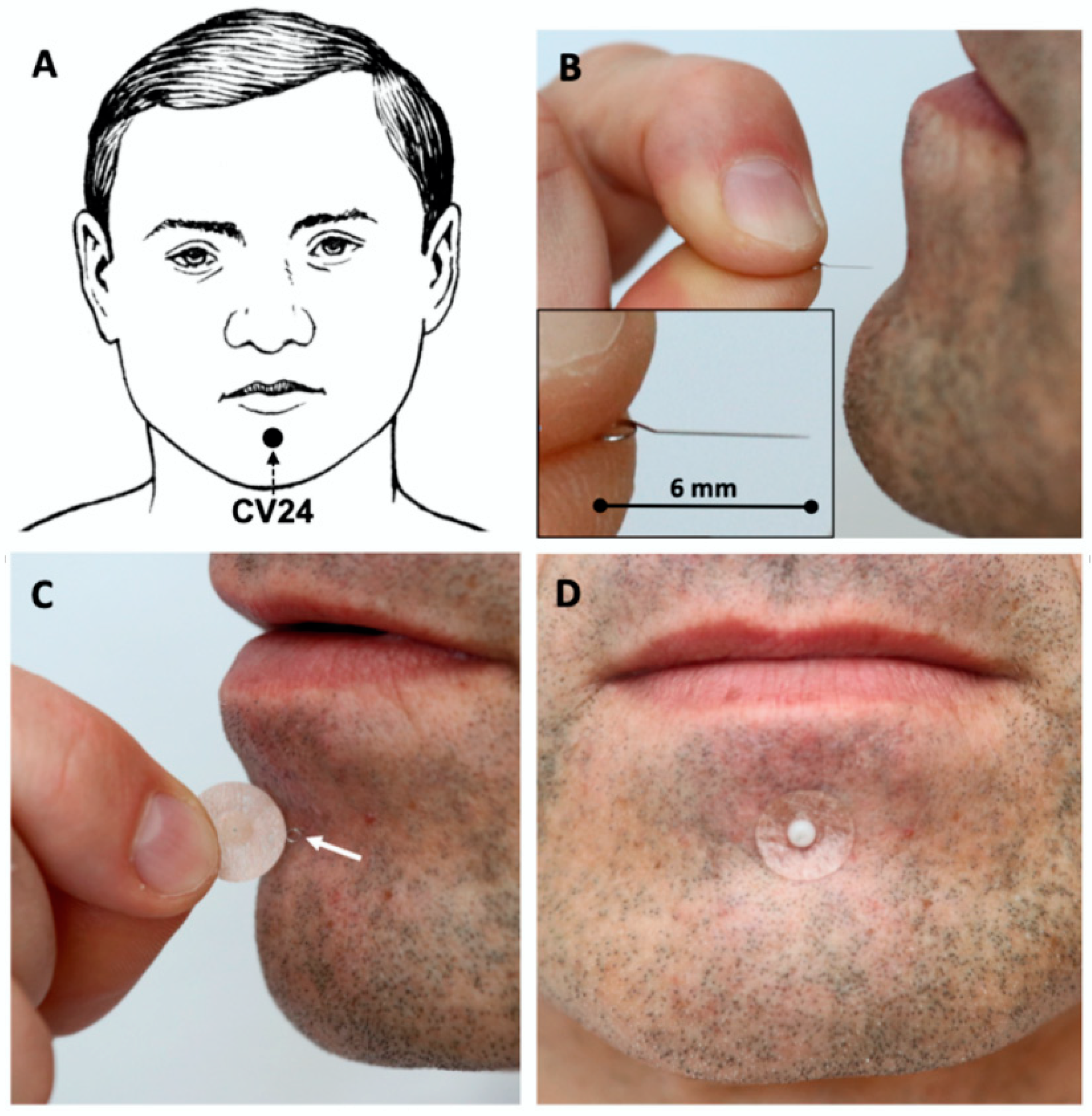 Medicines 07 00017 g003 Medicines 07 00017 g003