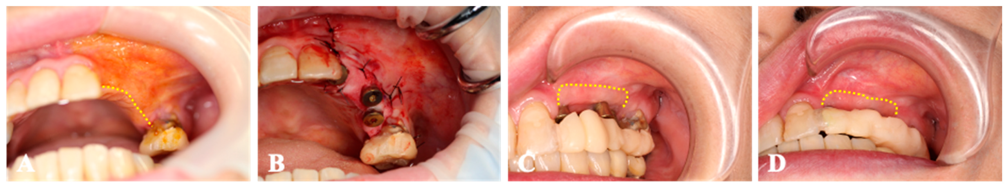 Medicines 10 00009 g005 Medicines 10 00009 g005