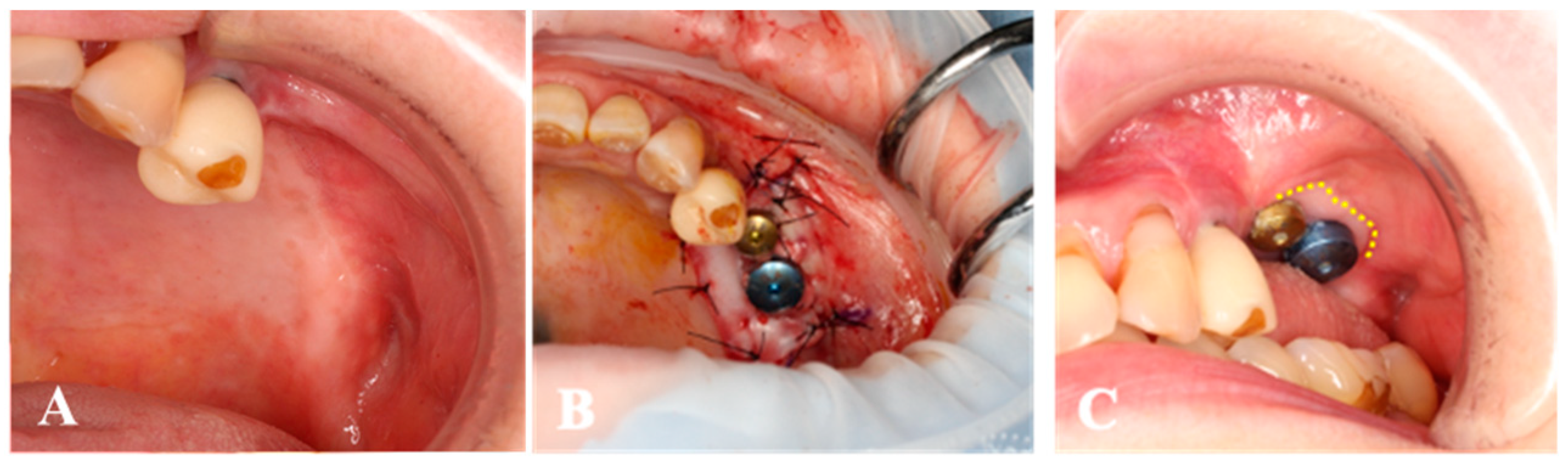 Medicines 10 00009 g006 Medicines 10 00009 g006