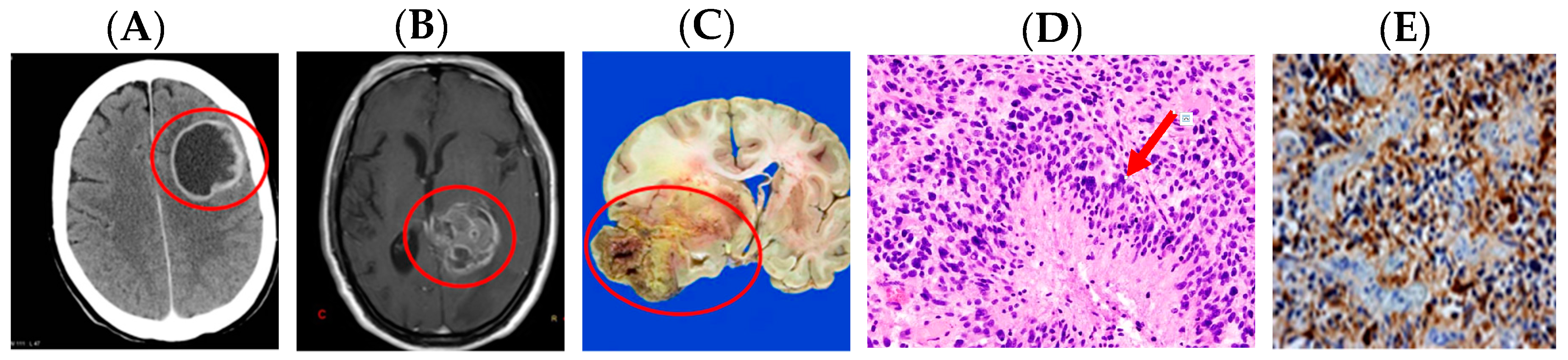 Medsci 05 00016 g006