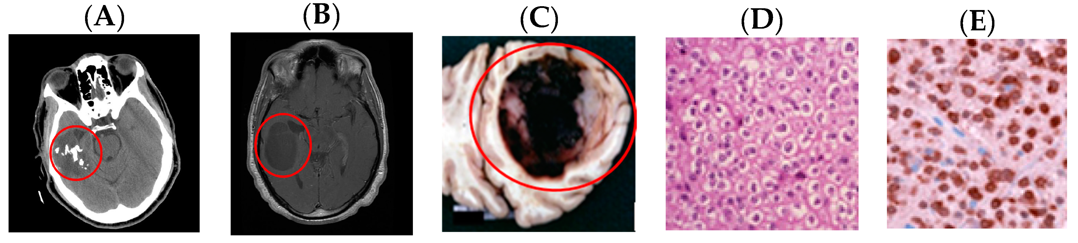 Medsci 05 00016 g007
