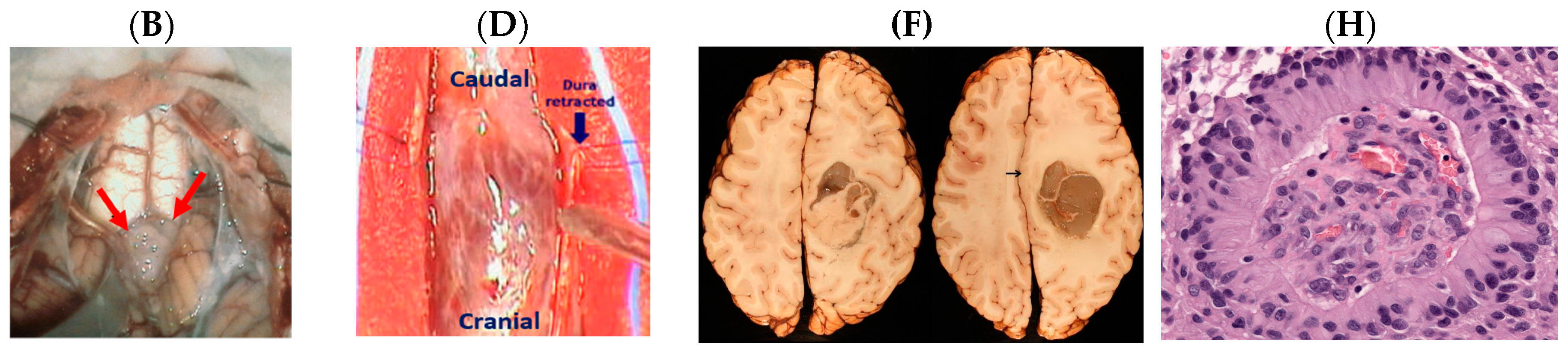 Medsci 05 00016 g008b