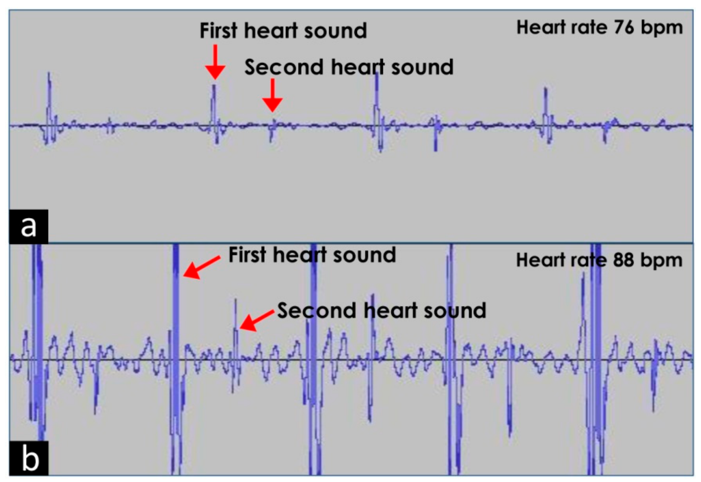 Medsci 06 00117 g005