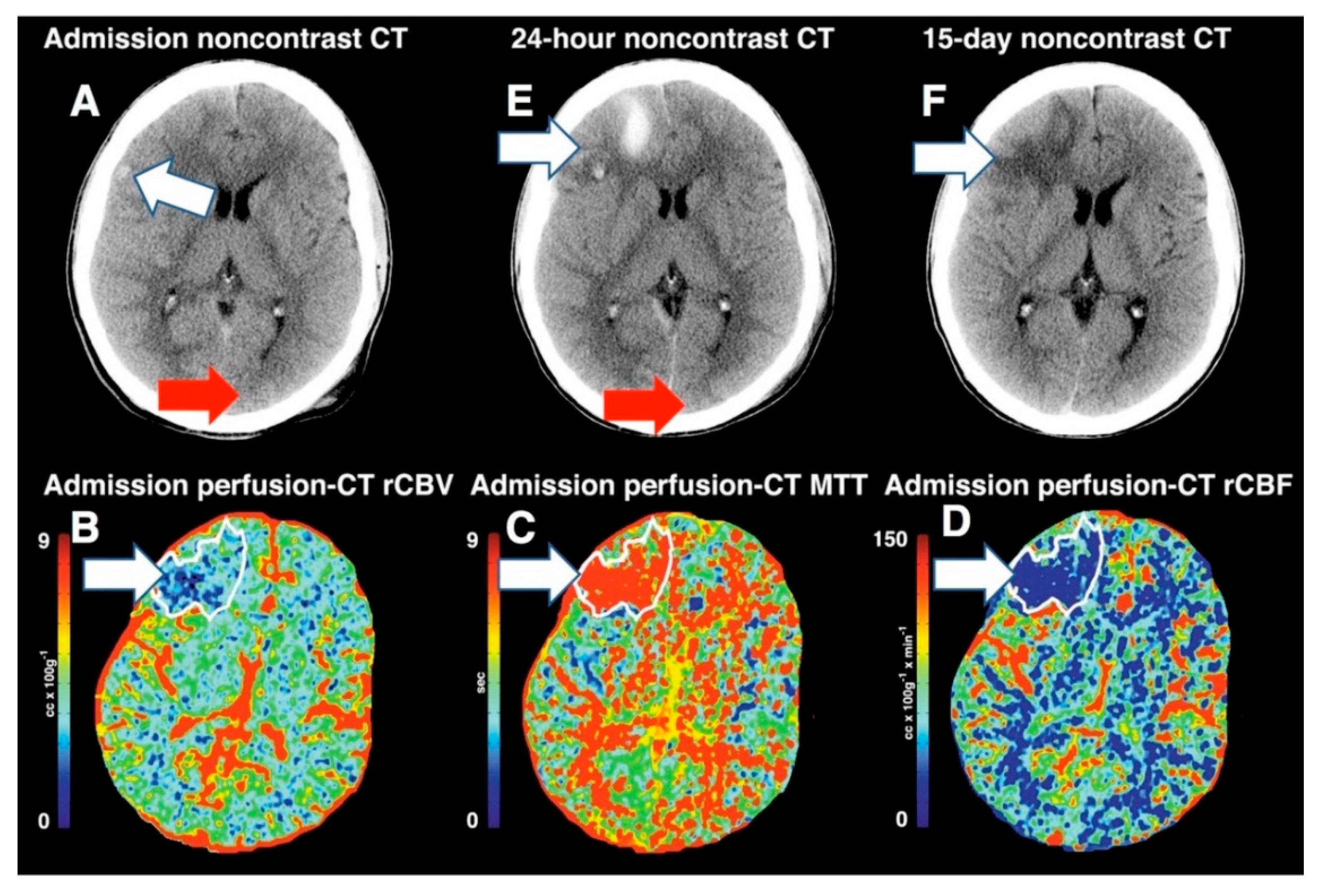 Medsci 07 00002 g005