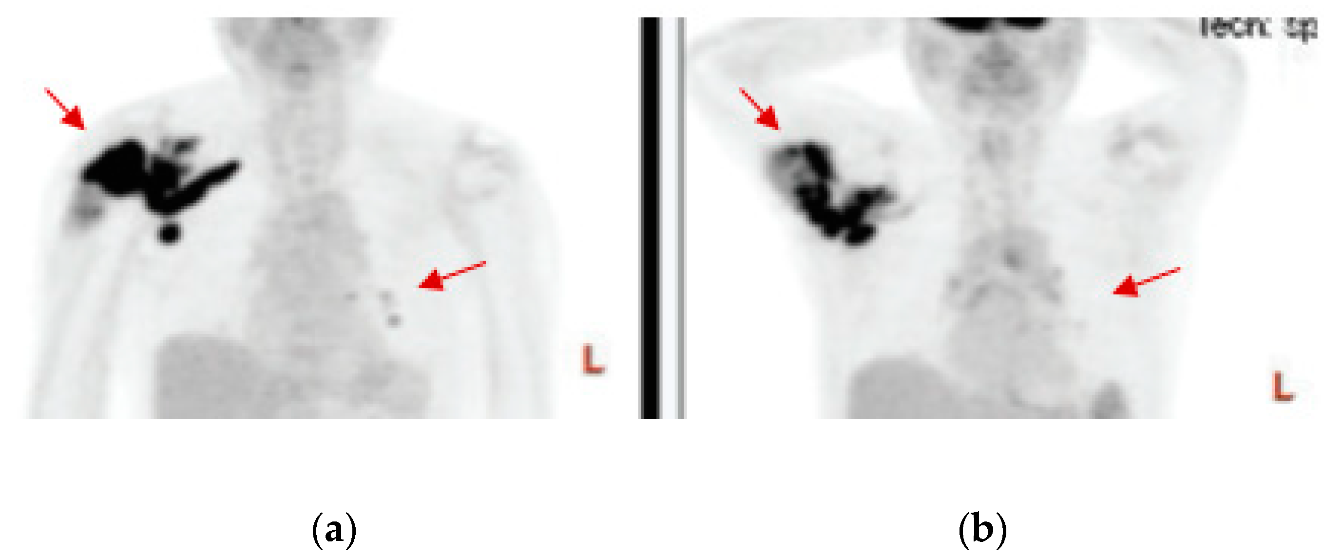 Medsci 07 00048 g004