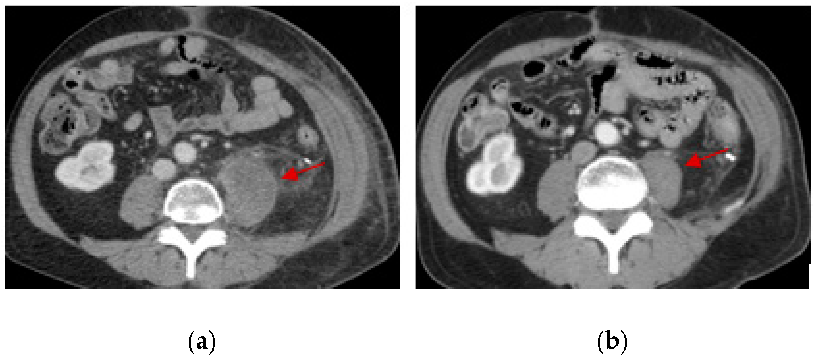 Medsci 07 00048 g005