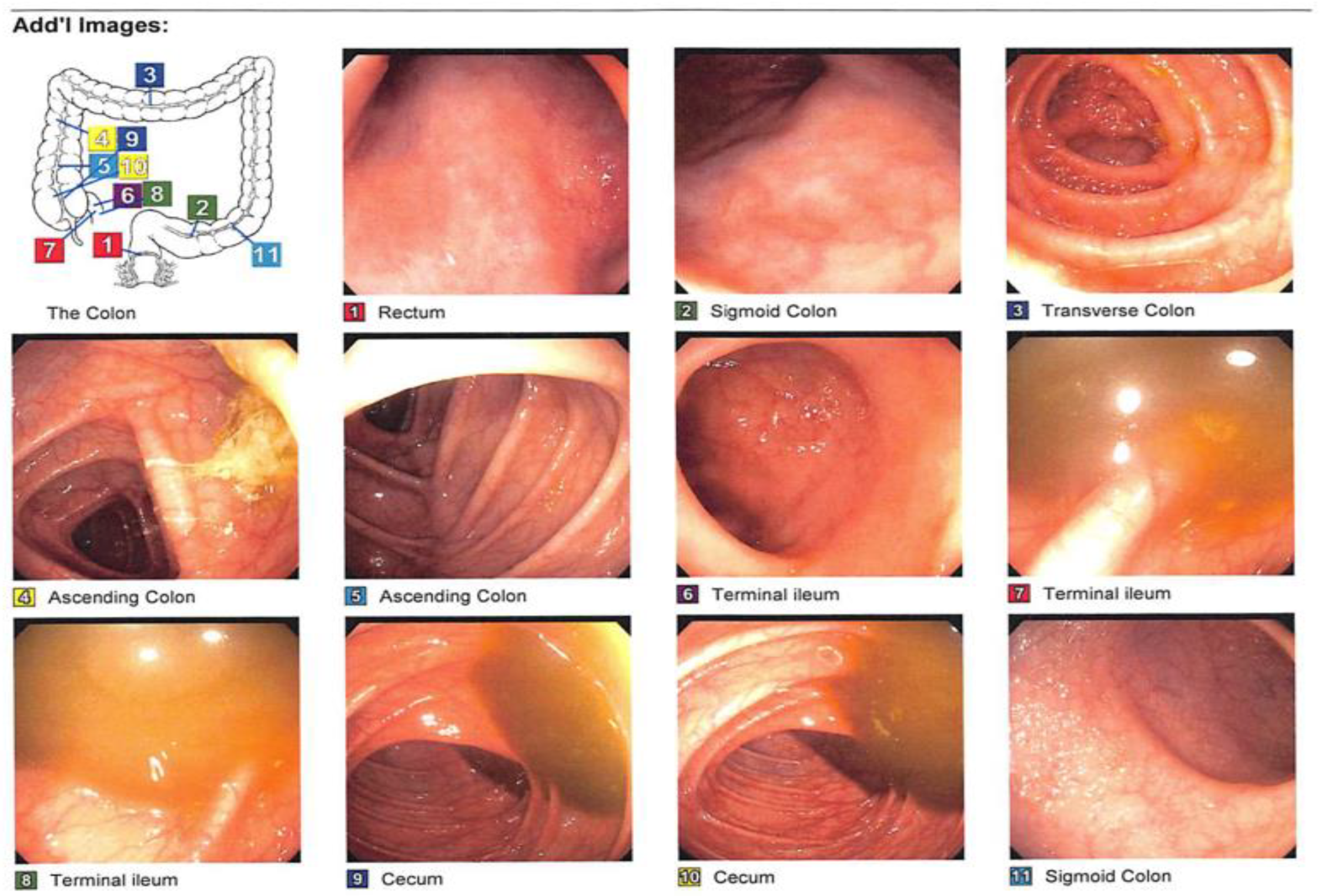 Medsci 11 00052 g004