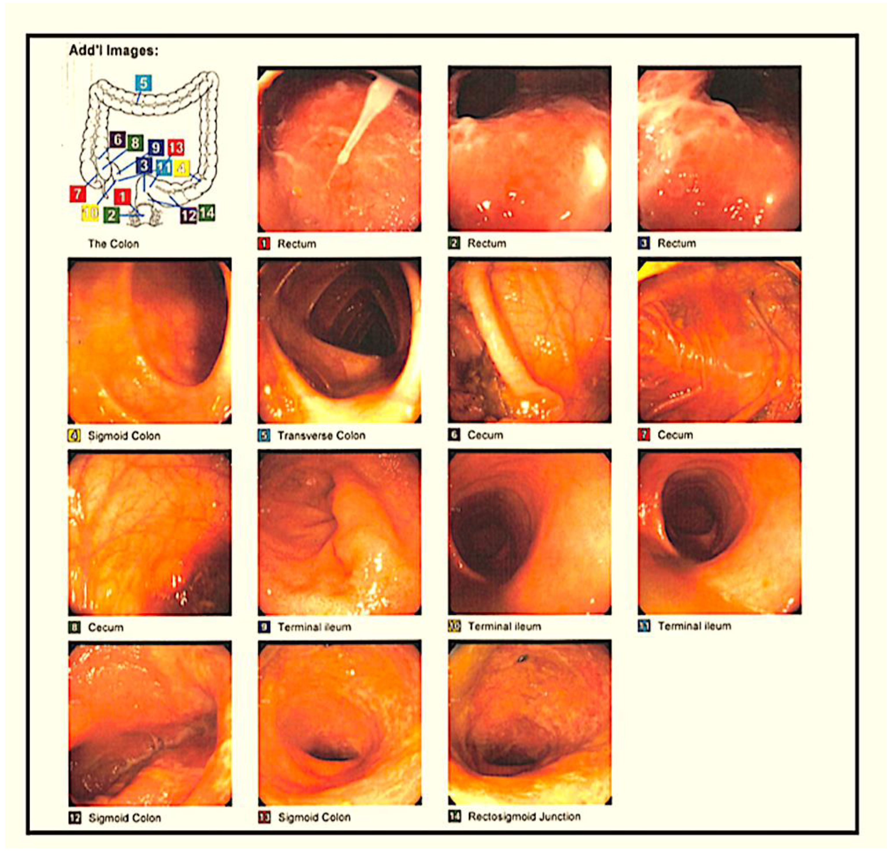 Medsci 11 00052 g005