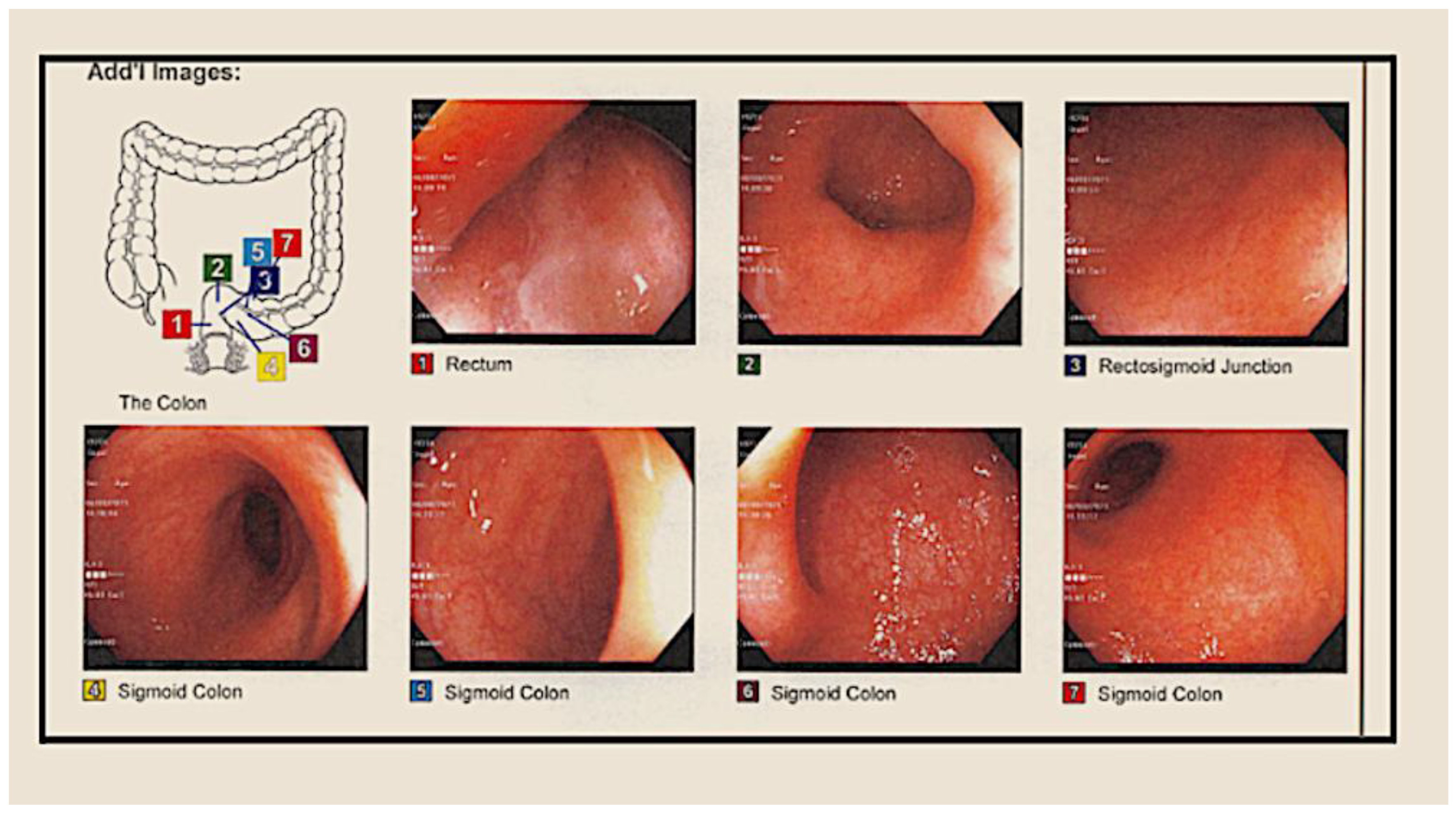 Medsci 11 00052 g006