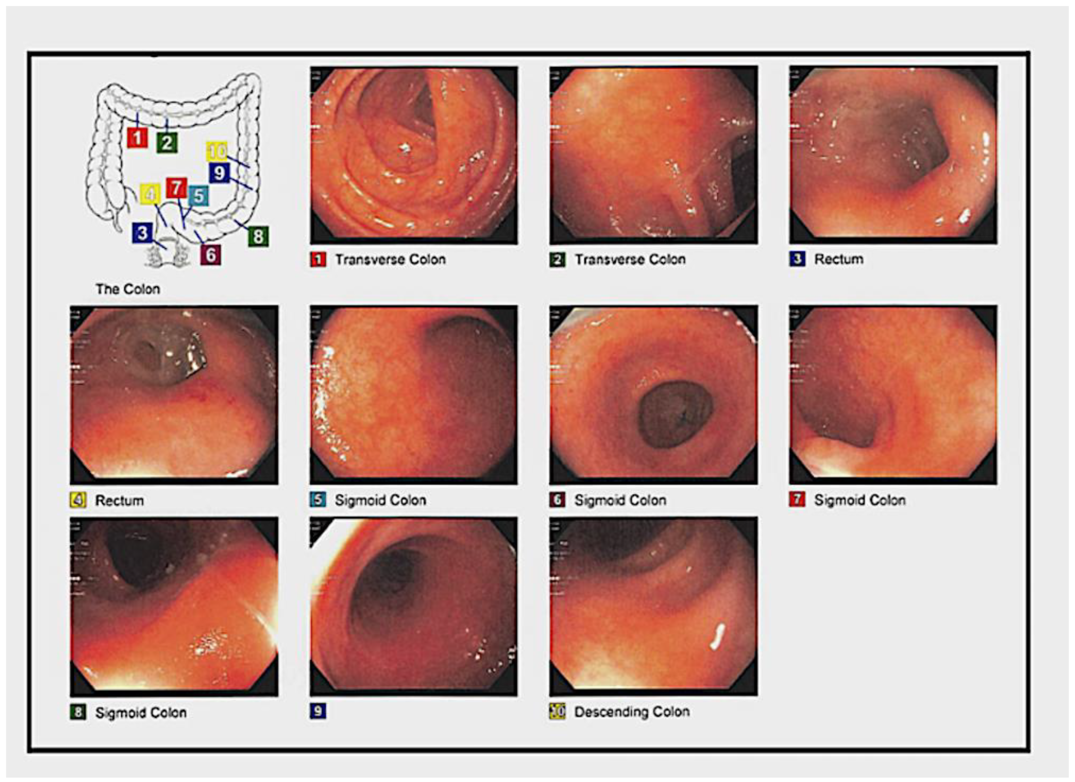 Medsci 11 00052 g007