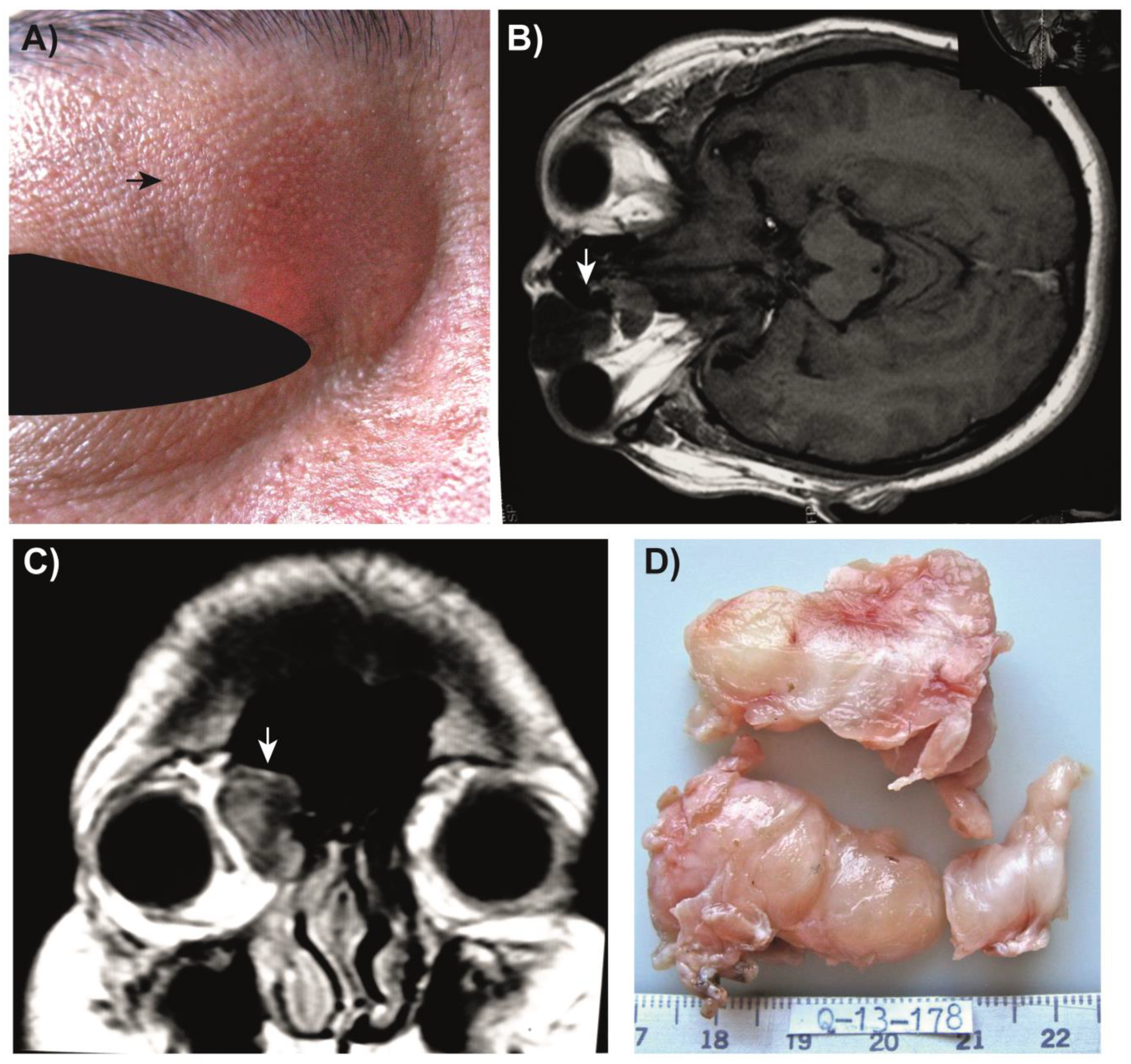 Medsci 11 00072 g001
