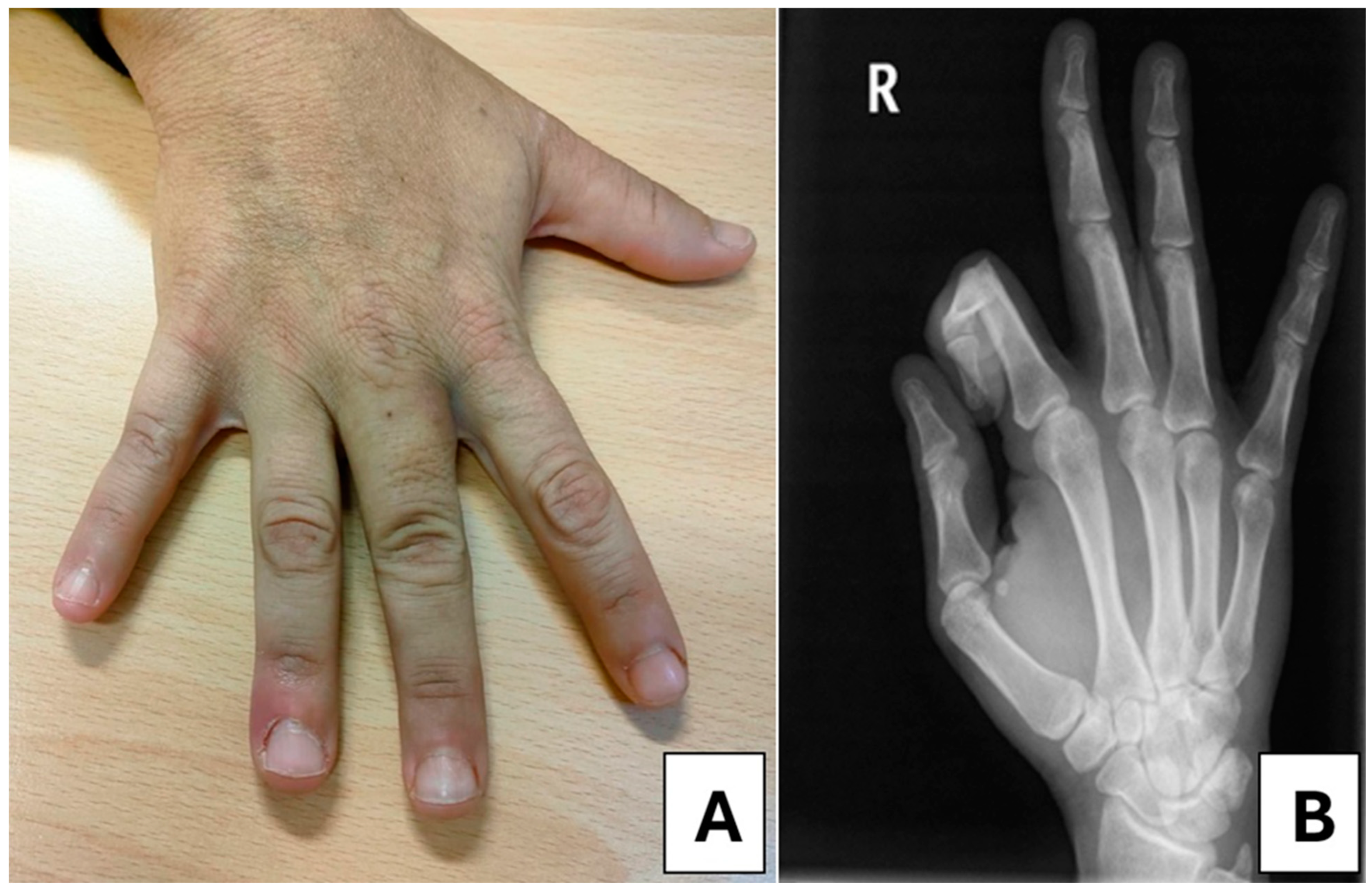 Medsci 13 00011 g003