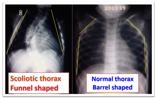 Medsci 13 00062 g006