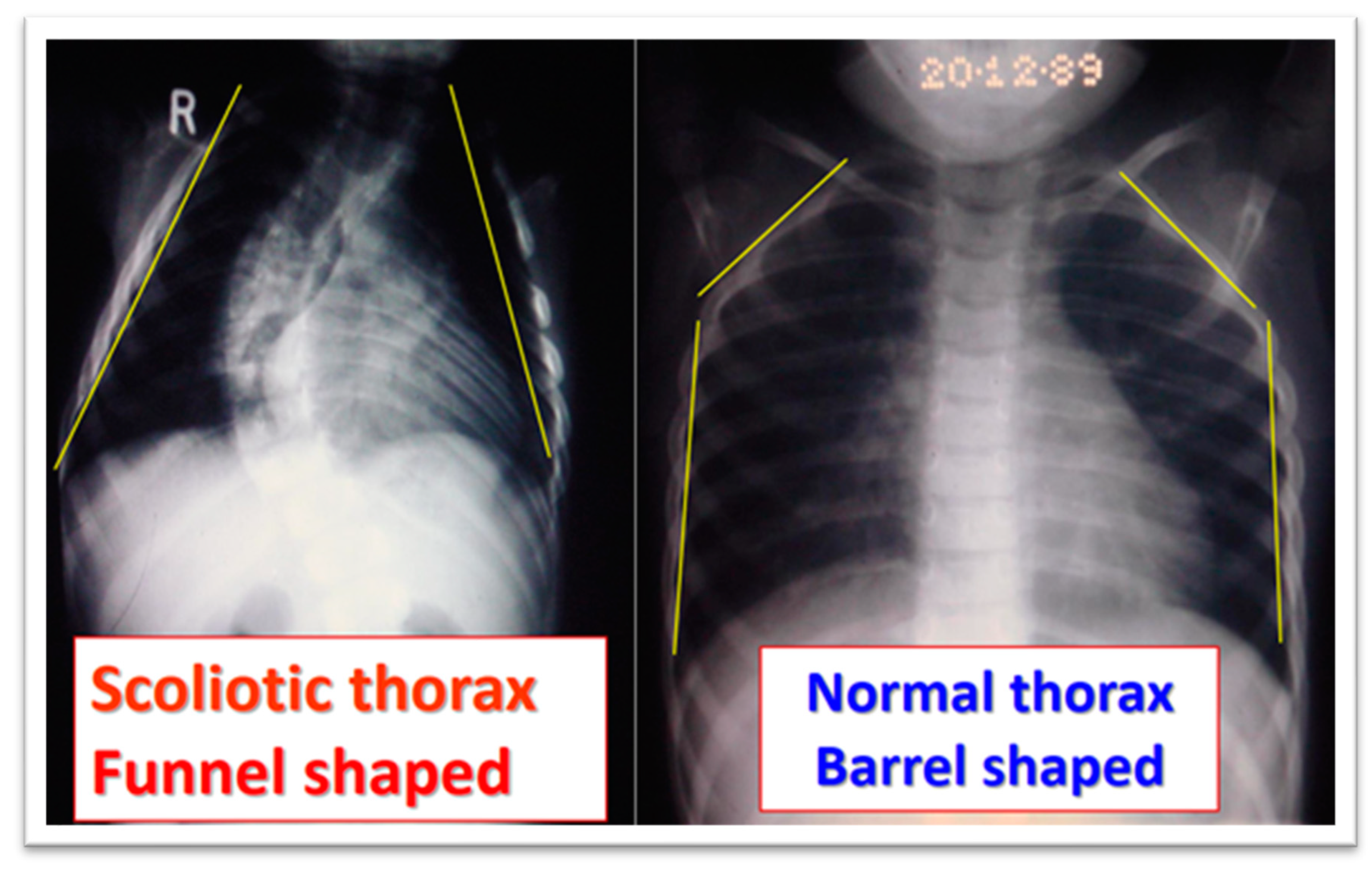 Medsci 13 00062 g006