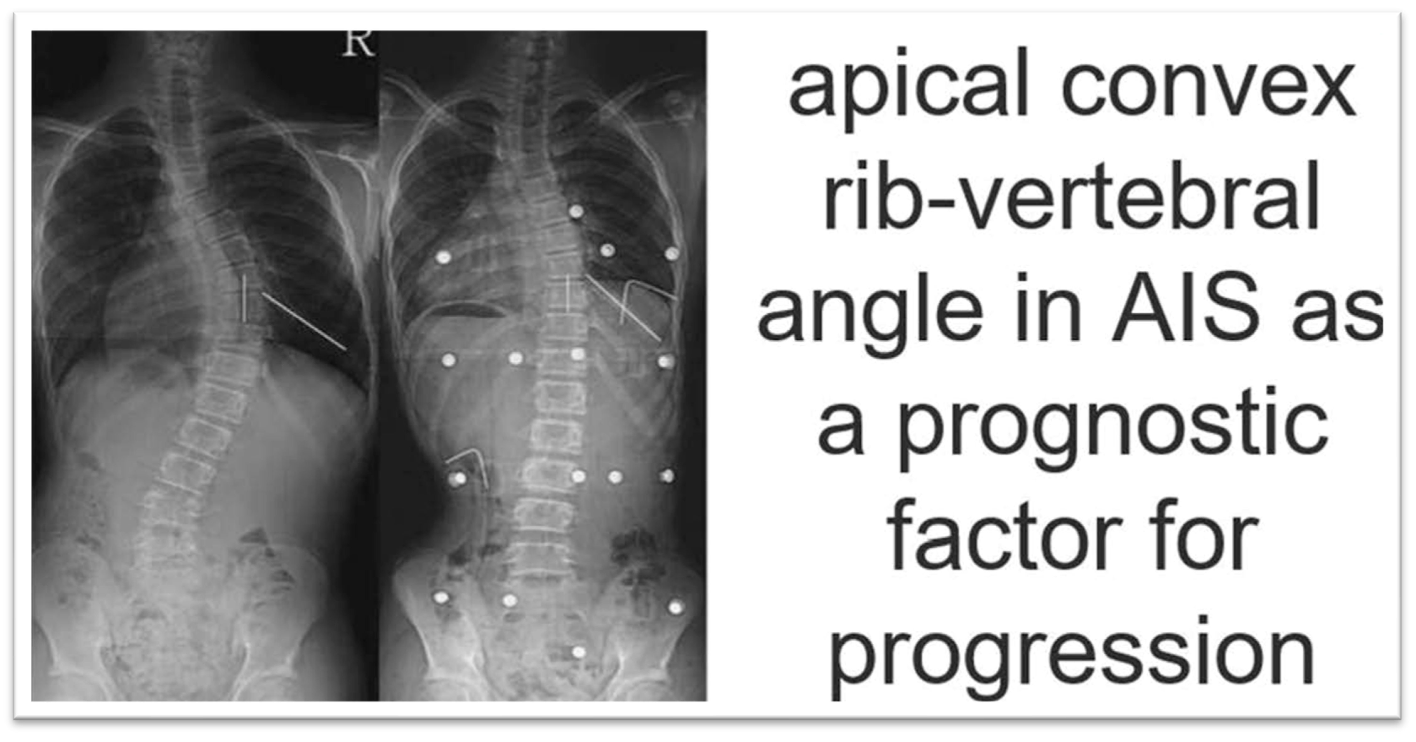 Medsci 13 00062 g012