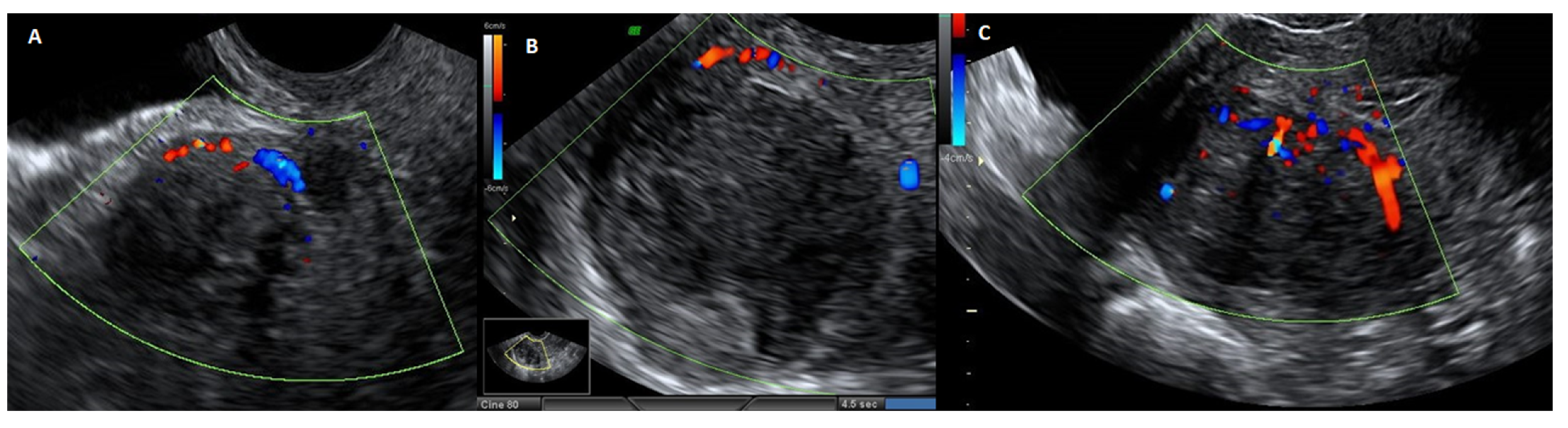 Medsci 13 00068 g005