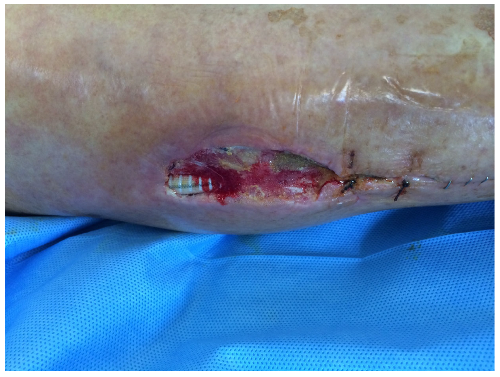 Medsci 13 00071 g001