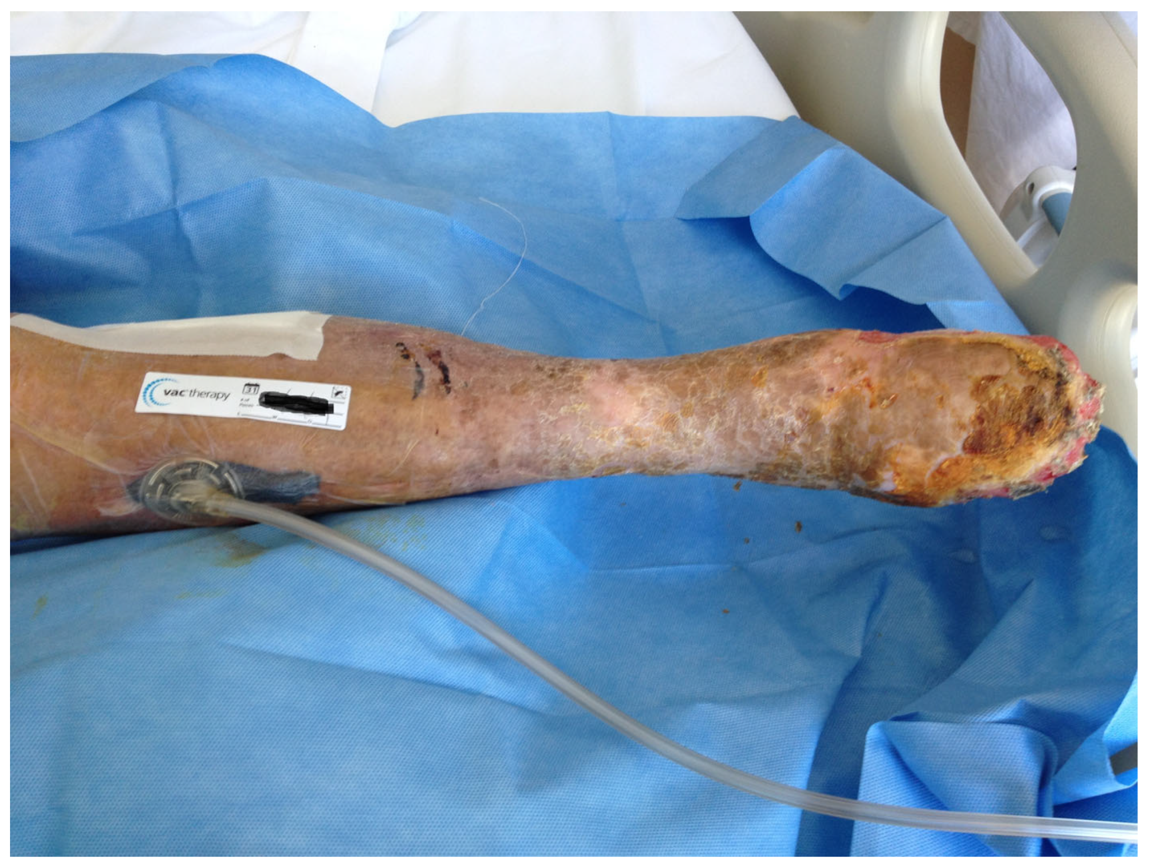 Medsci 13 00071 g002