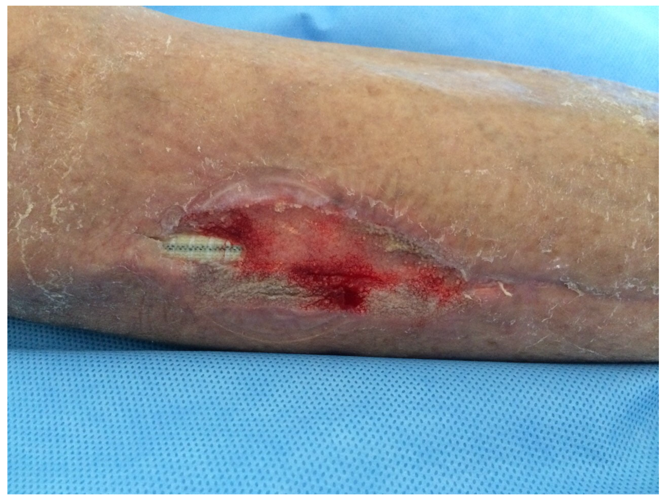 Medsci 13 00071 g003