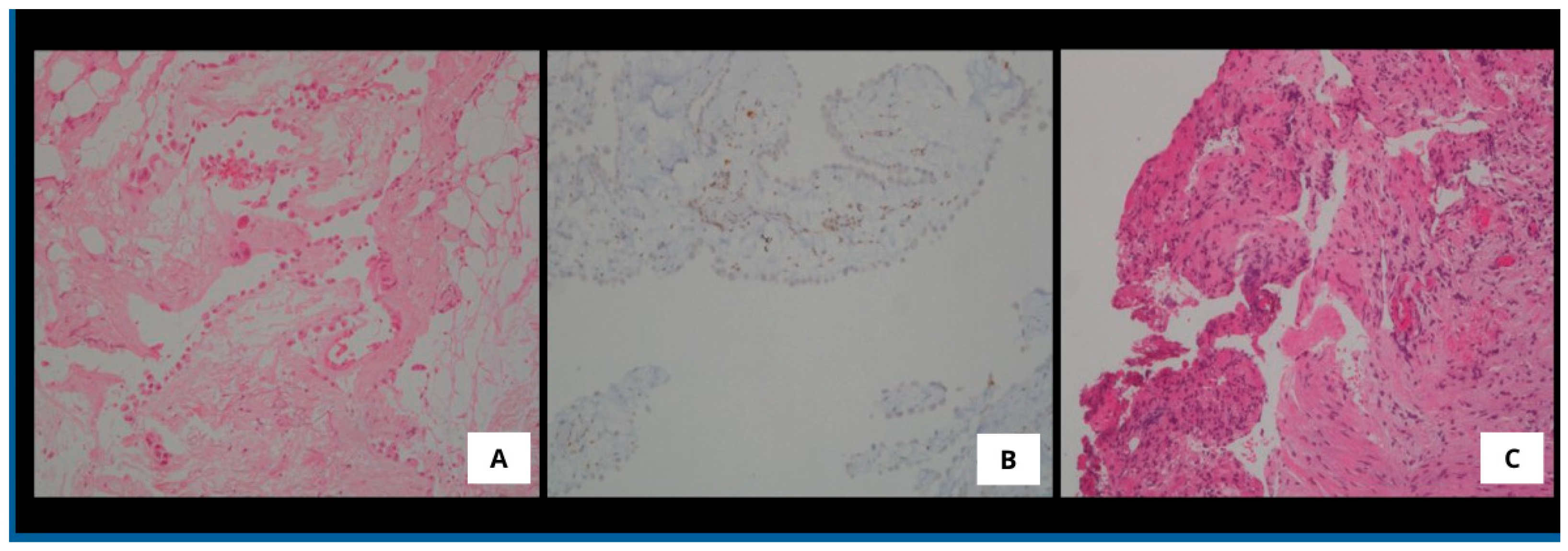 Medsci 13 00072 g004