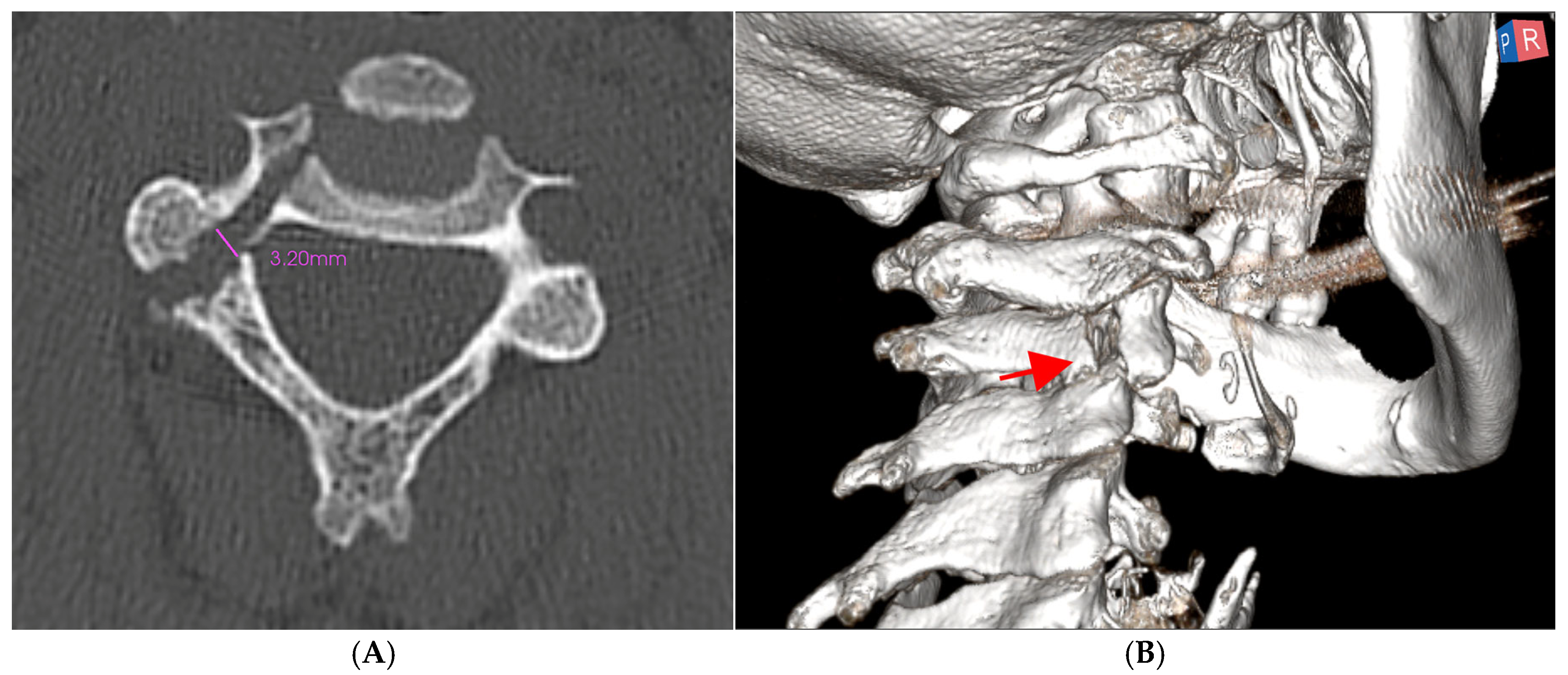 Medsci 13 00092 g002