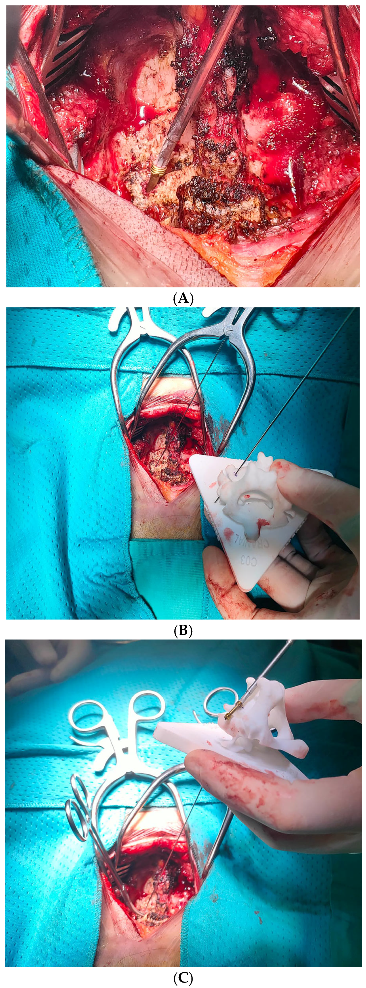 Medsci 13 00092 g004a