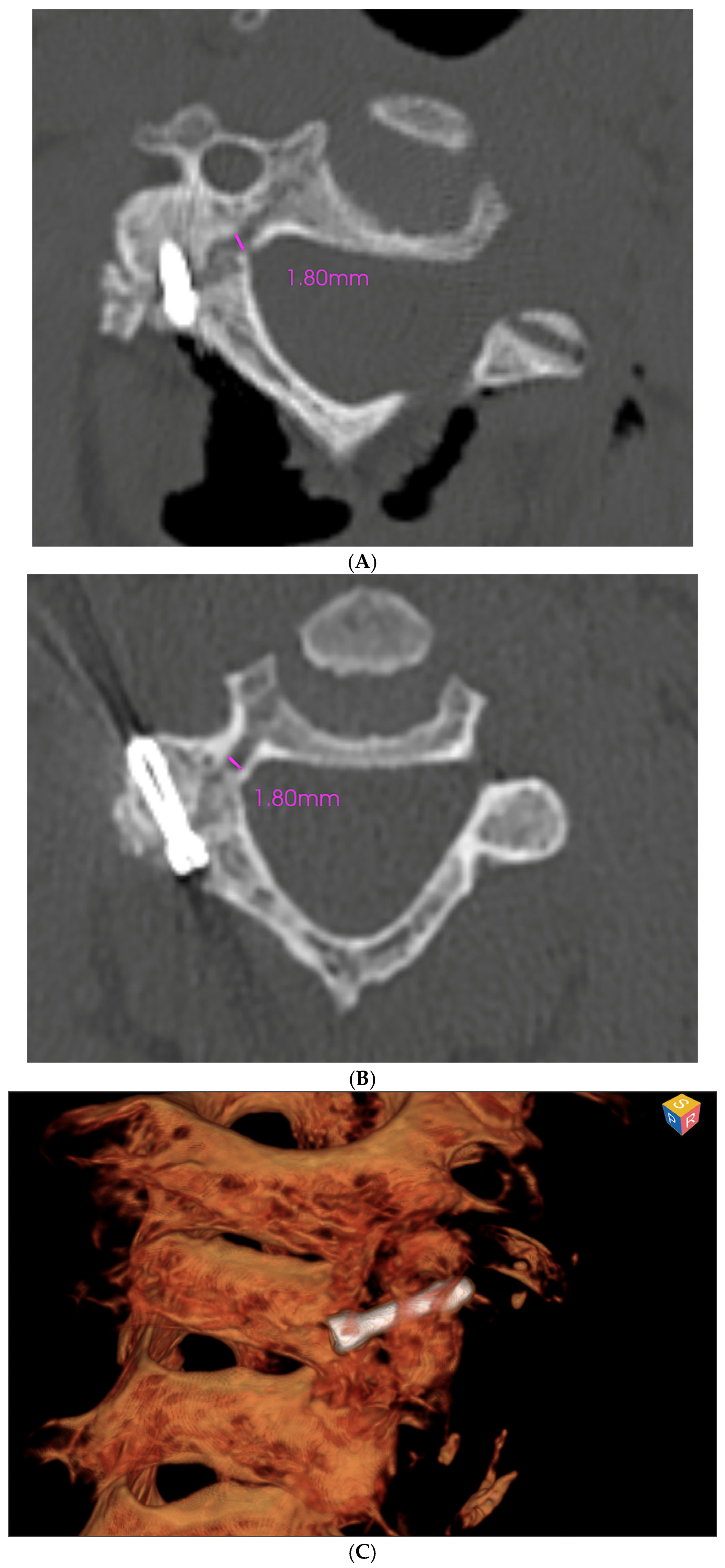 Medsci 13 00092 g005