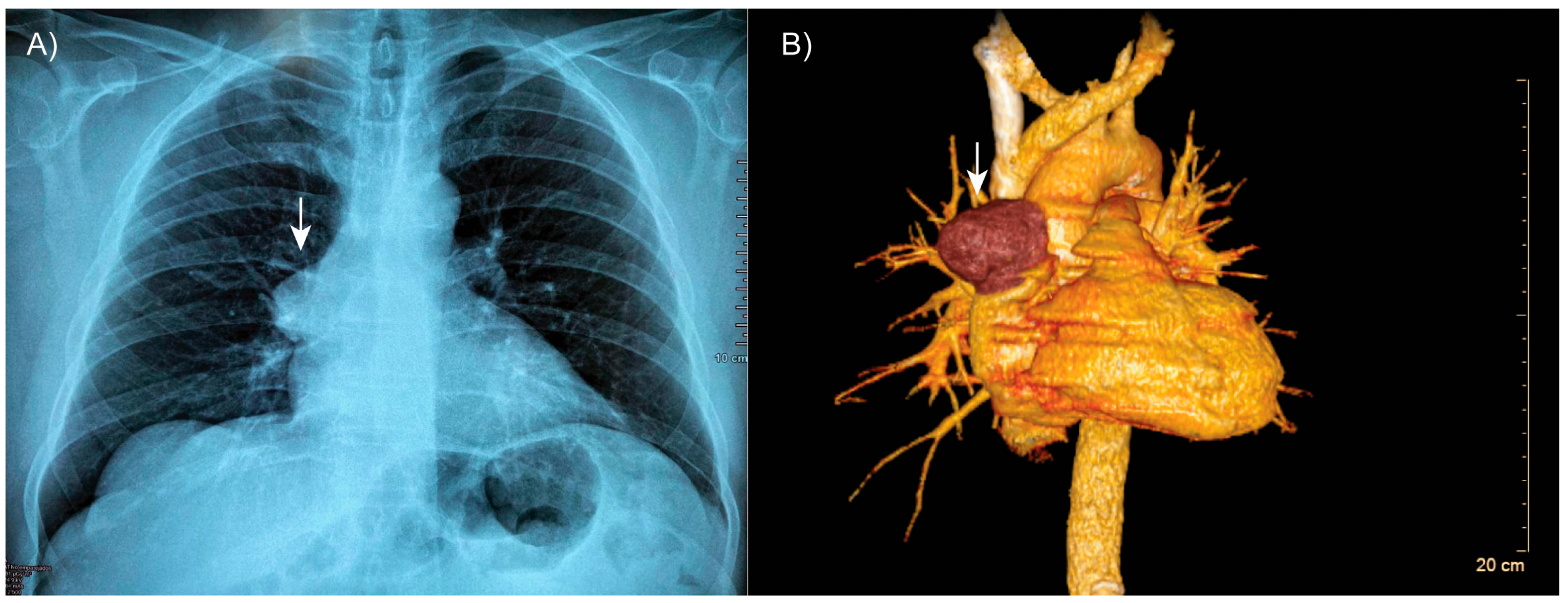 Medsci 13 00096 g001