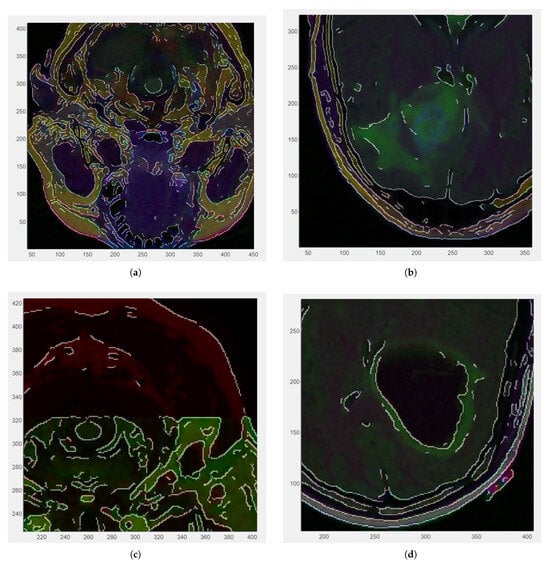 Medsci 13 00097 g003