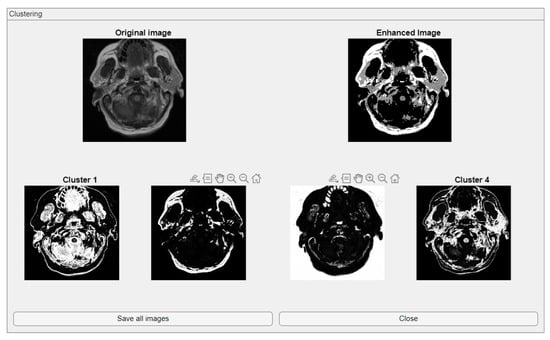 Medsci 13 00097 g004